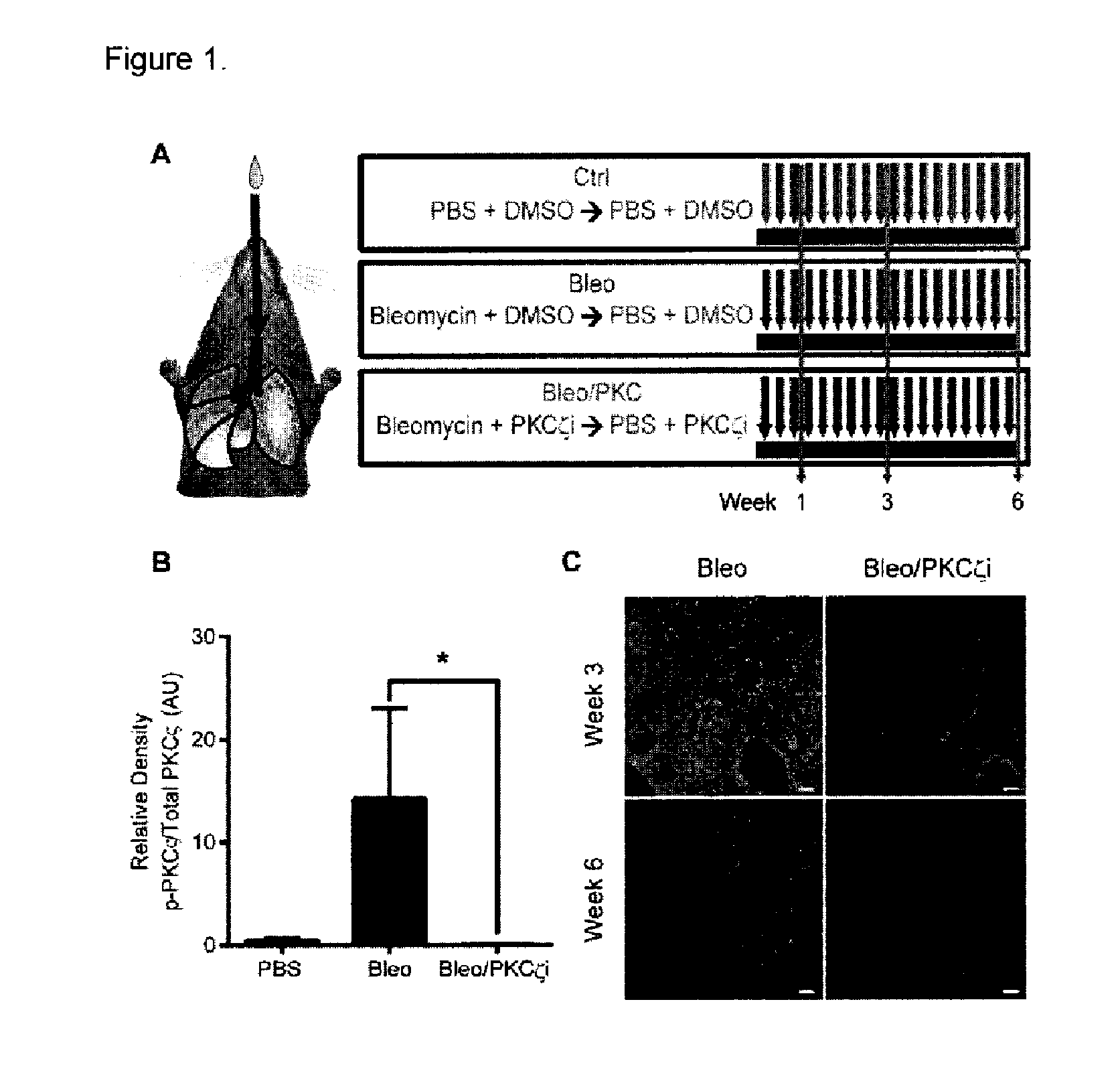 Lung injury repair compositions and methods