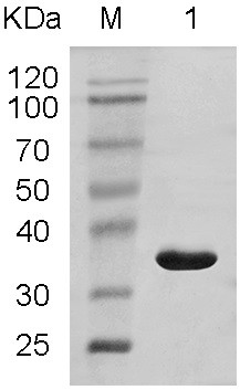Anti-trichina small heat shock protein egg yolk antibody as well as preparation method and application thereof
