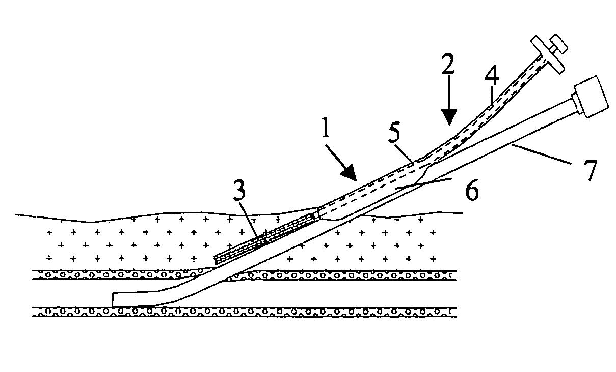 Closure device