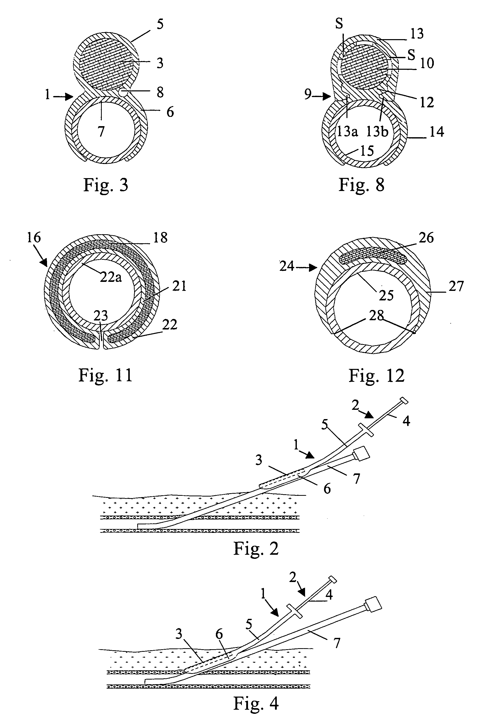 Closure device