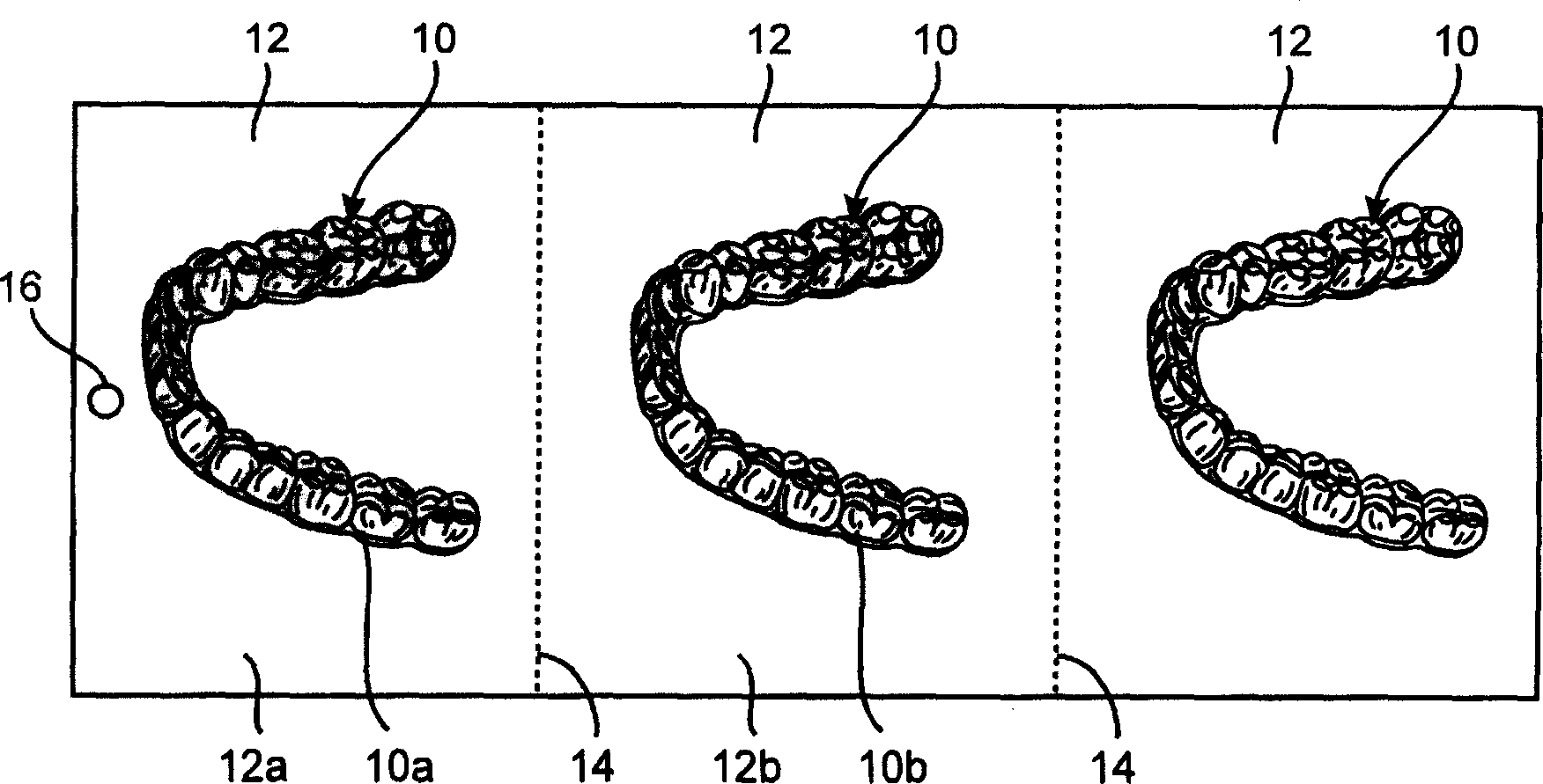 Dental appliance sequence ordering system and method