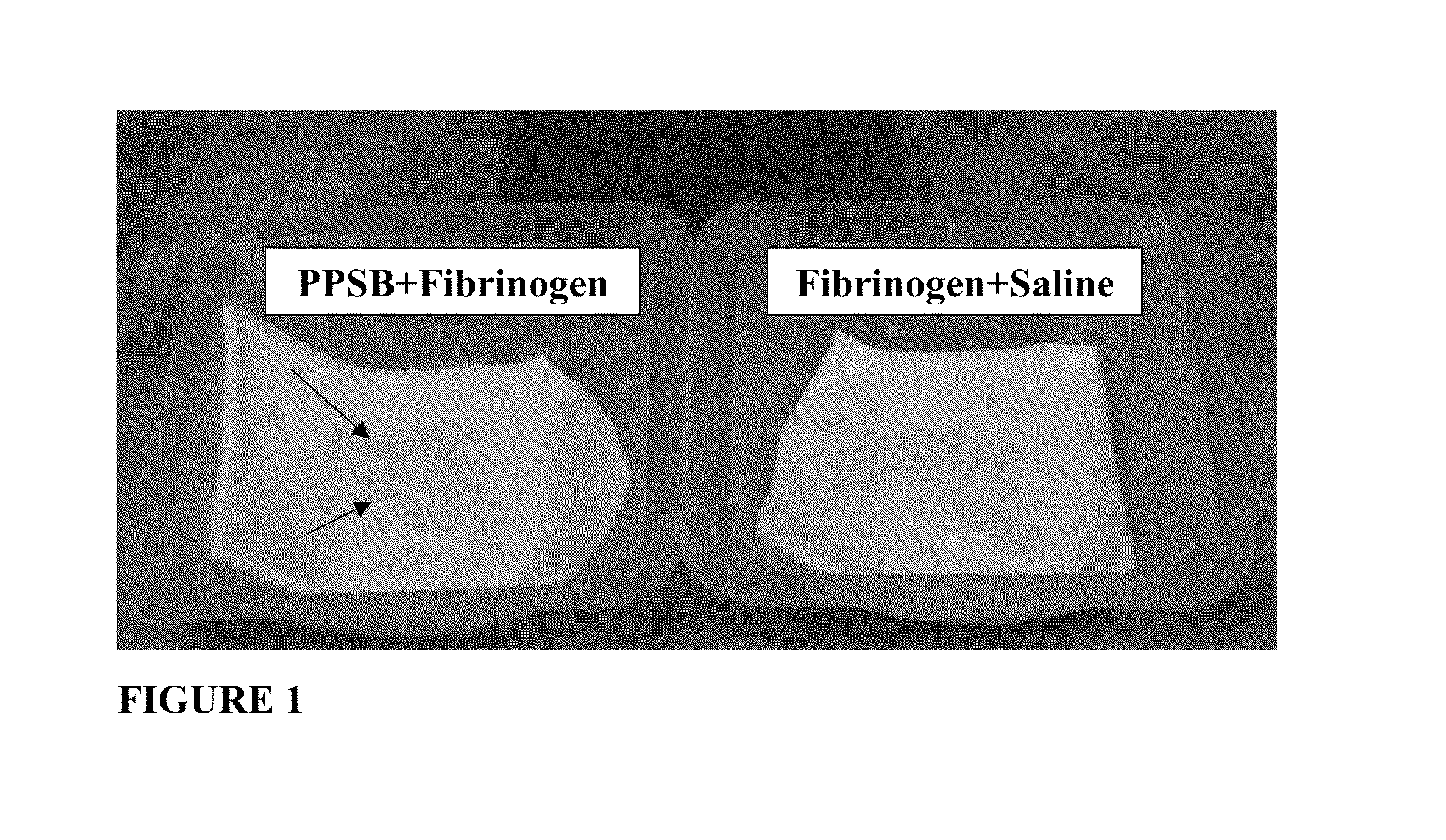 One component fibrin glue comprising zymogens