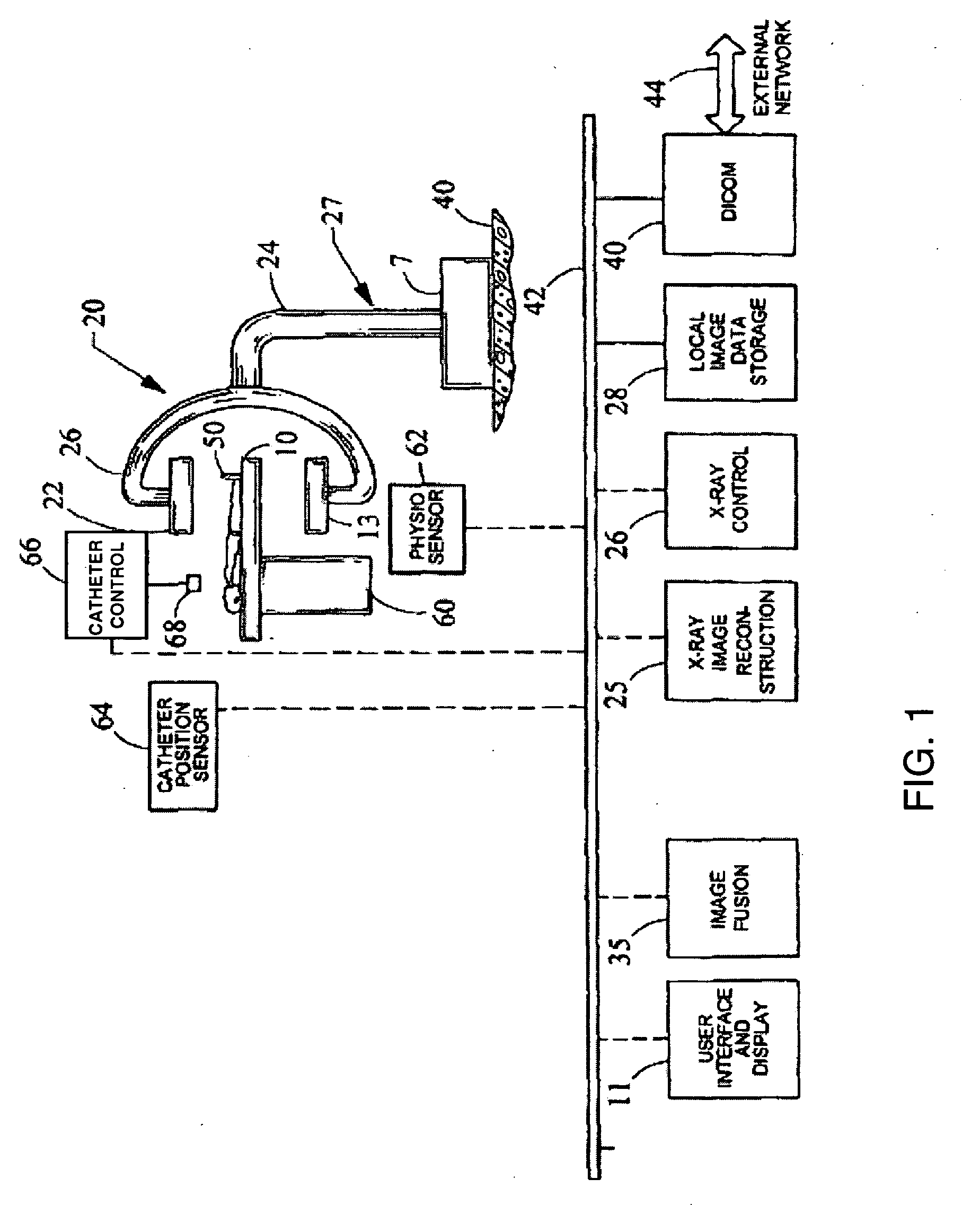 Method and system for virtual roadmap imaging