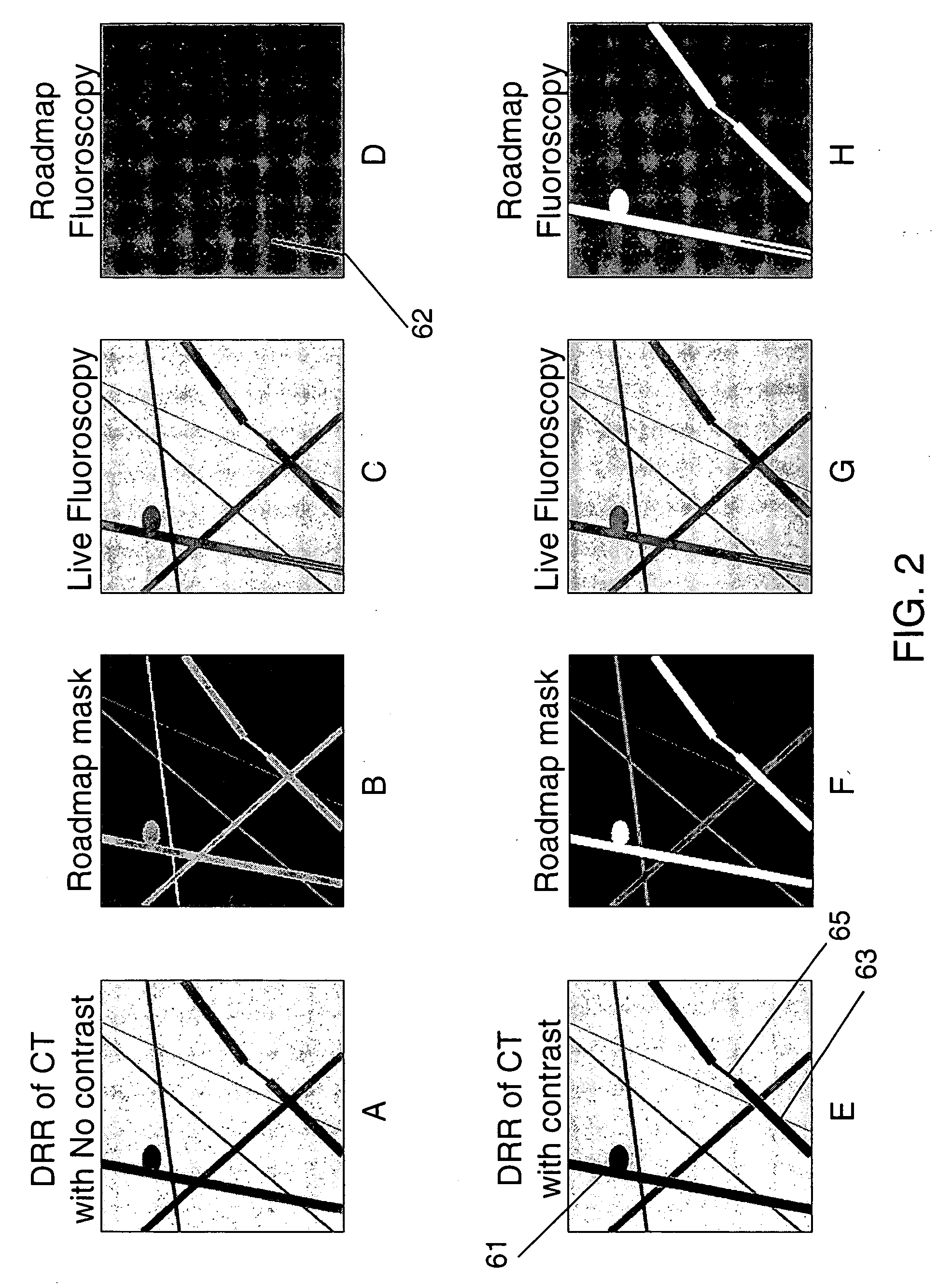 Method and system for virtual roadmap imaging