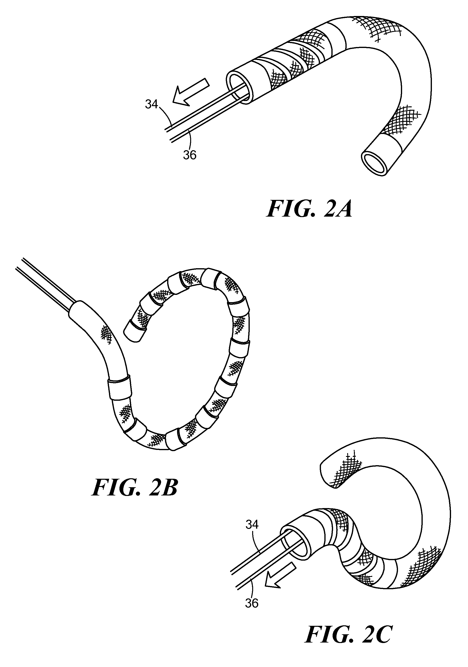 Bi-modal linear and loop ablation catheter, and method