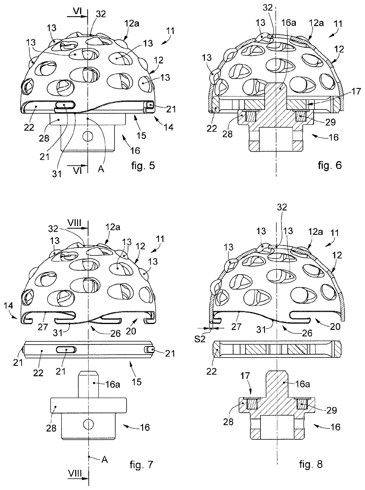 Milling Head for a Milling Tool for Prosthetic Surgery Operations and Corresponding Milling Tool