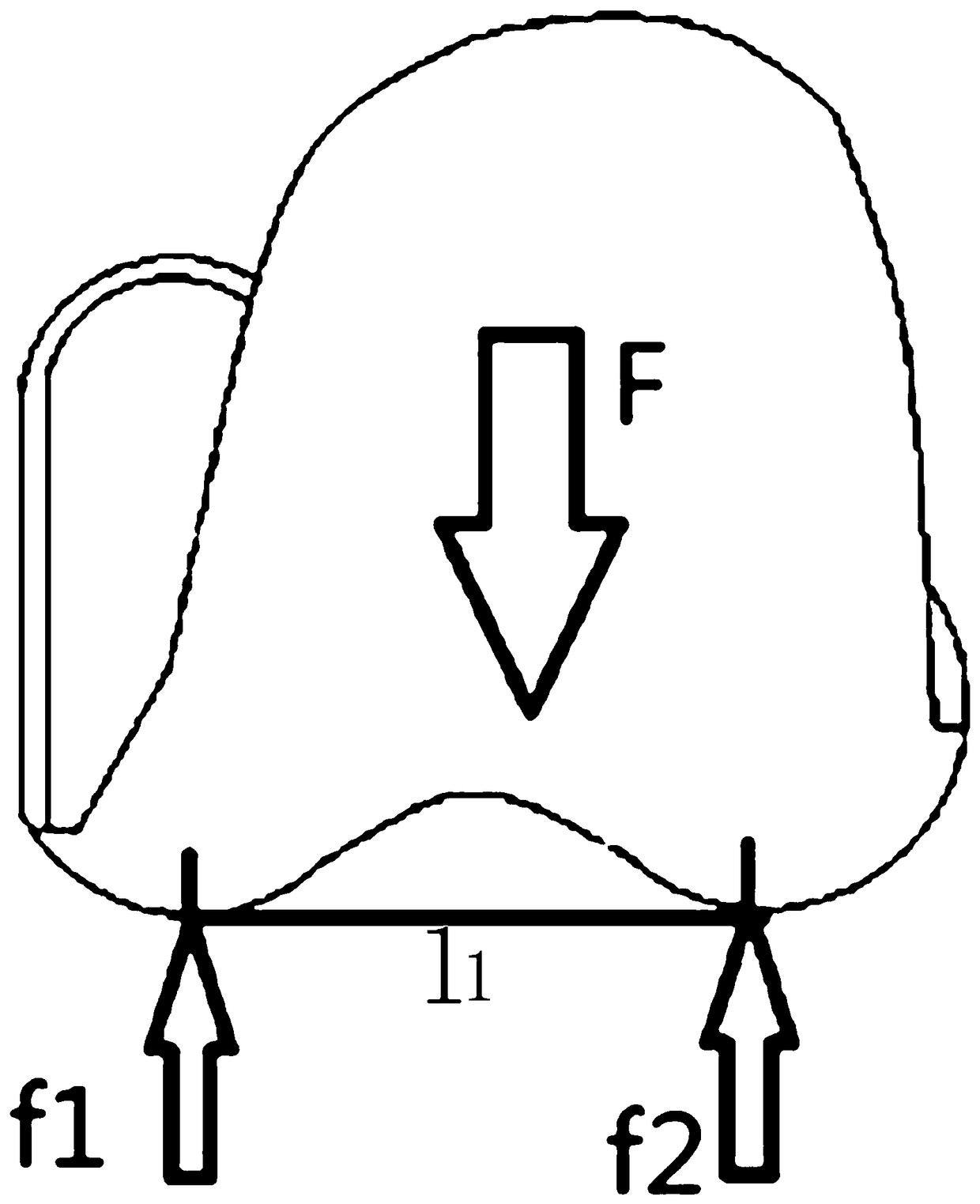 Design method of a customized artificial knee prosthesis