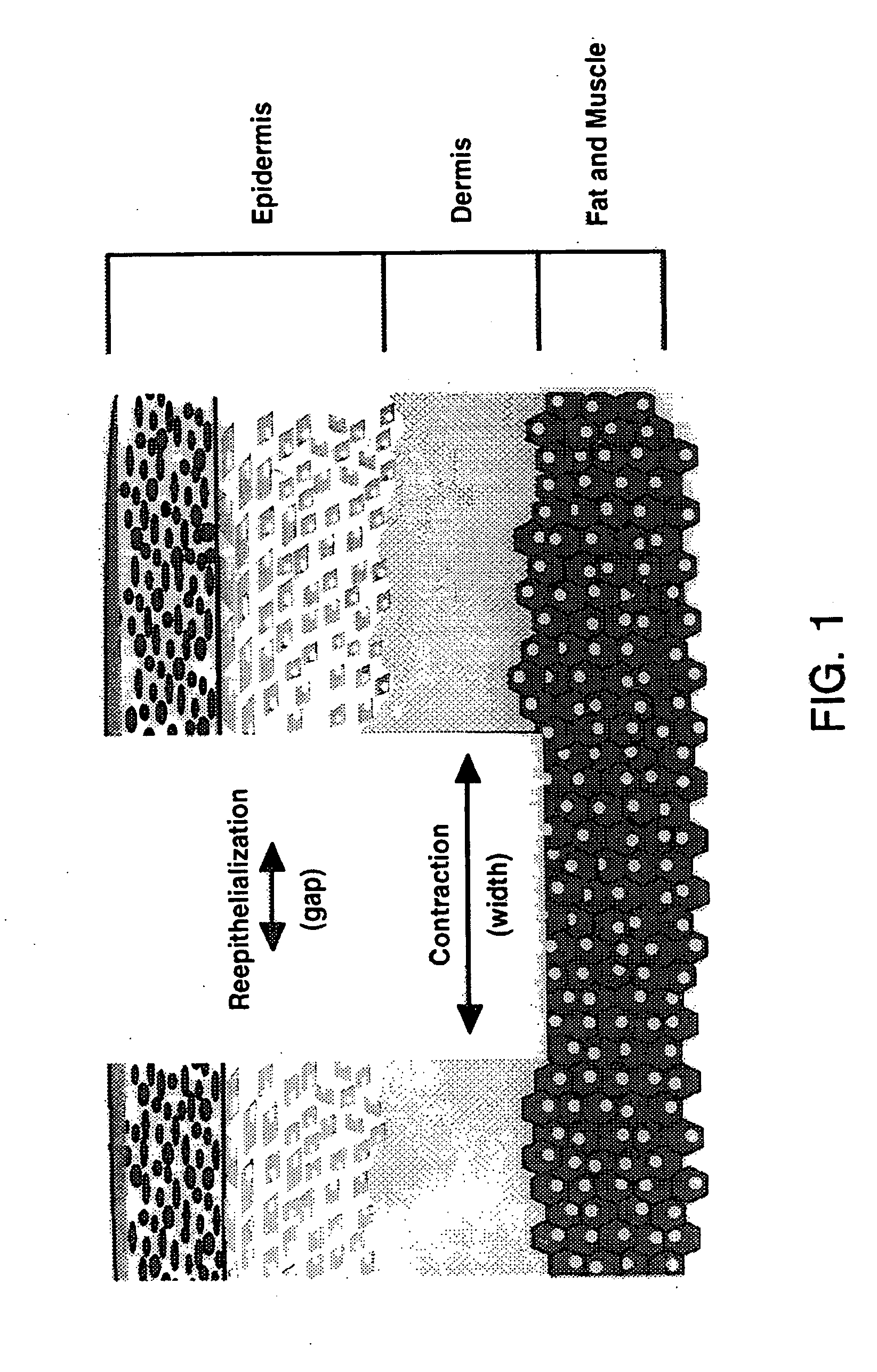 Treatment of skin, and wound repair, with thymosin beta 4