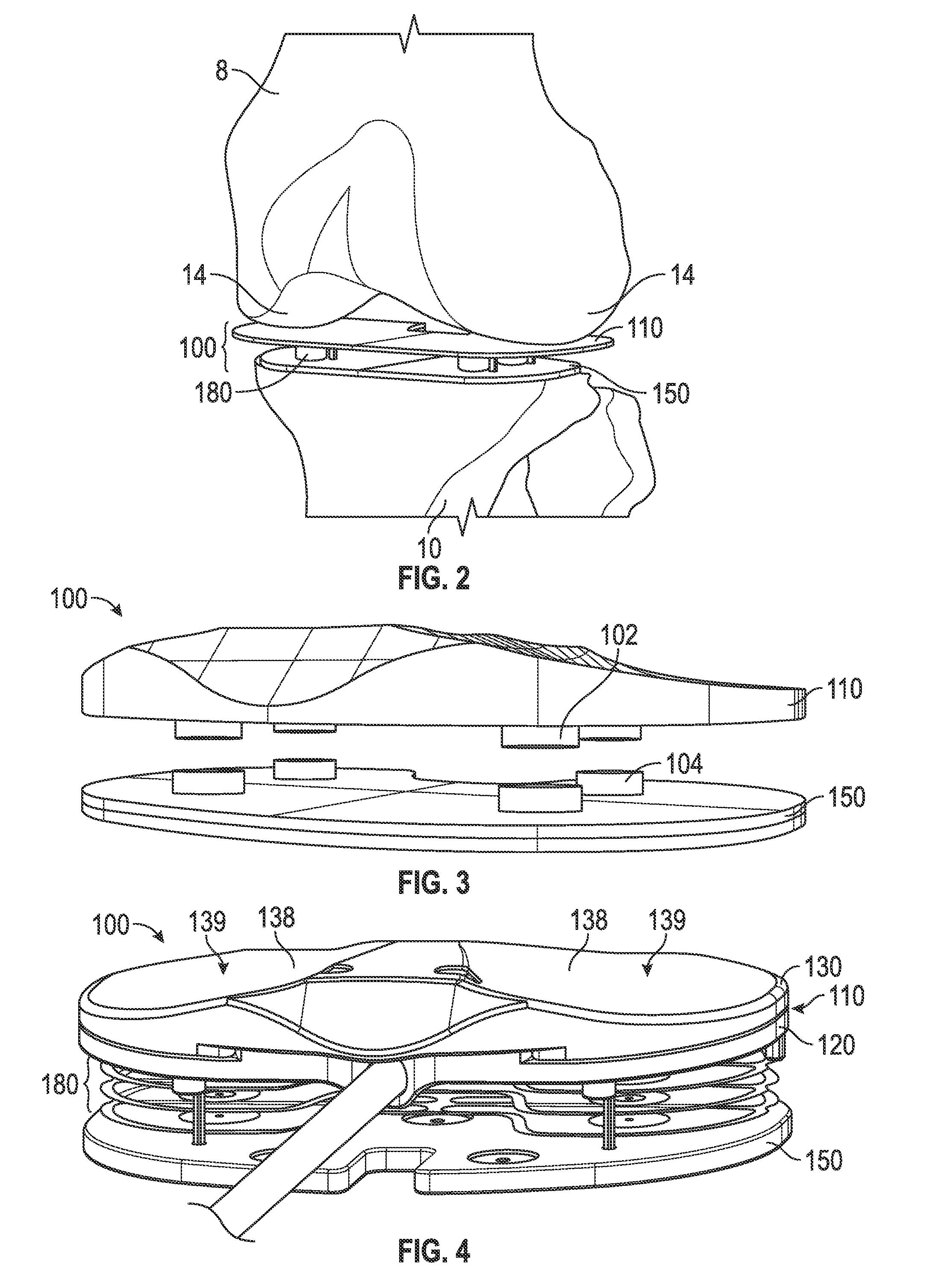 Actuated positioning device for arthroplasty and methods of use