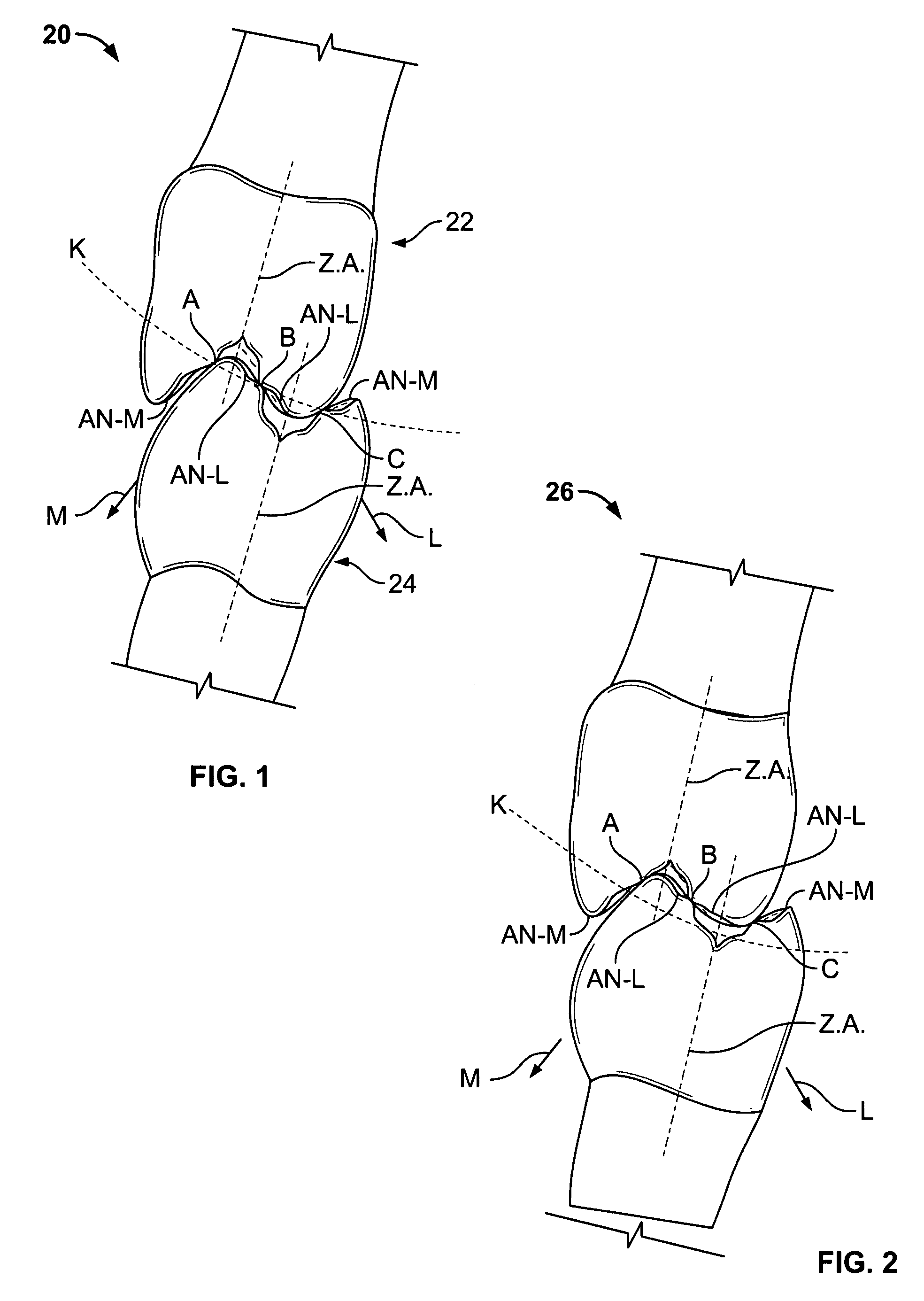 Set of teeth