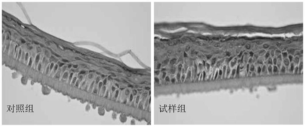 Composition for promoting metabolism of aged skin as well as preparation method and application of composition