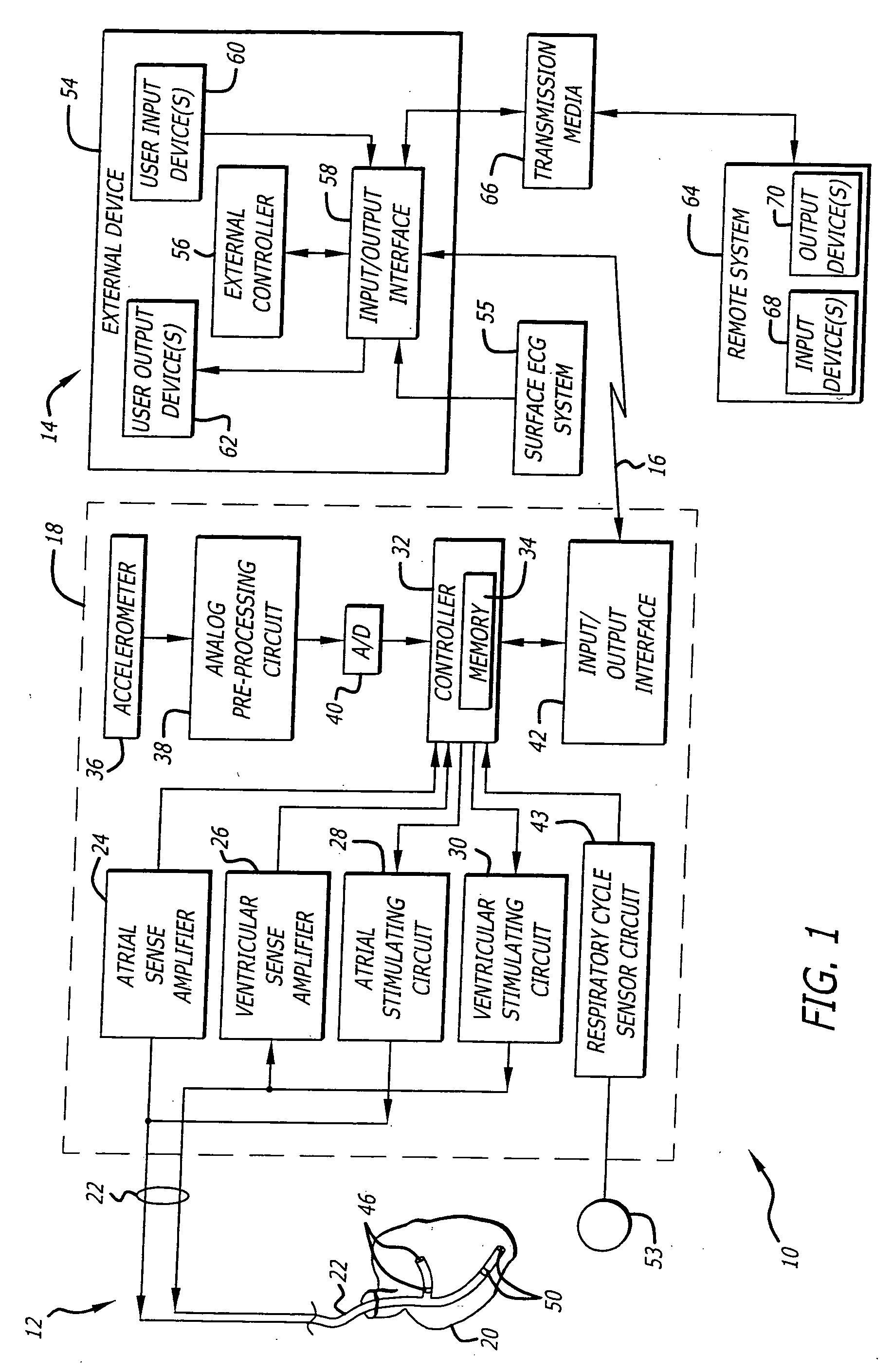 Apparatus and method for detecting lung sounds using an implanted device