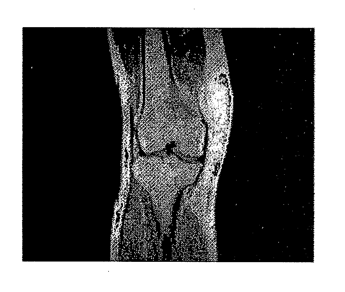 Multi-channel magnetic resonance imaging reconstruction method for water-fat separation