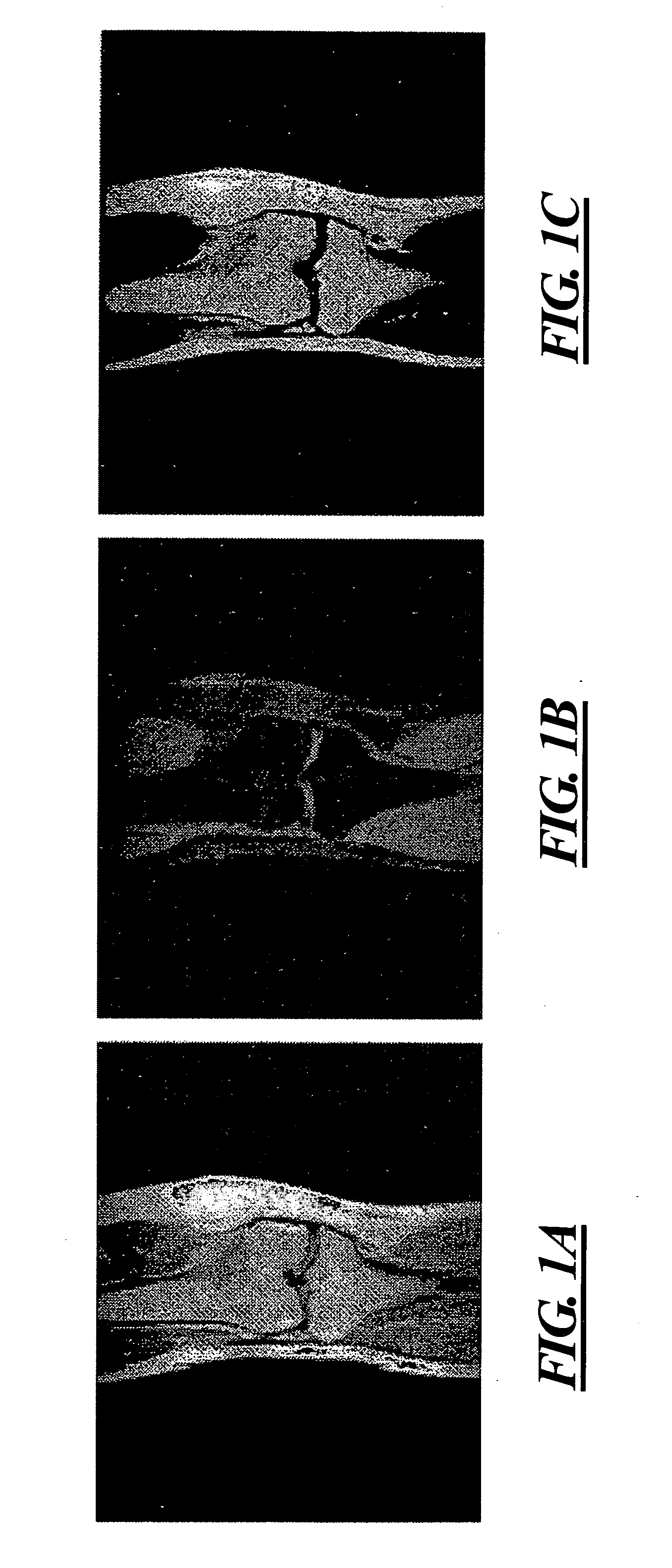 Multi-channel magnetic resonance imaging reconstruction method for water-fat separation