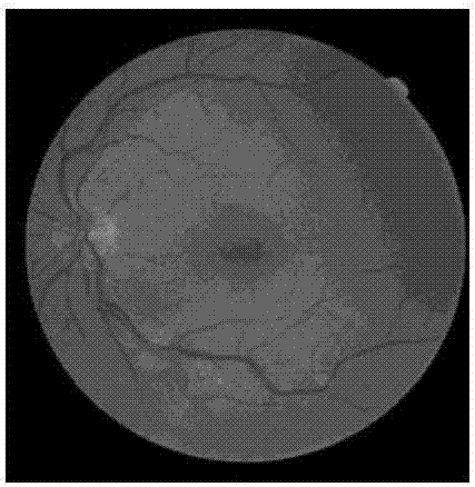 Efficient CNN-CRF network-based retina image segmentation method