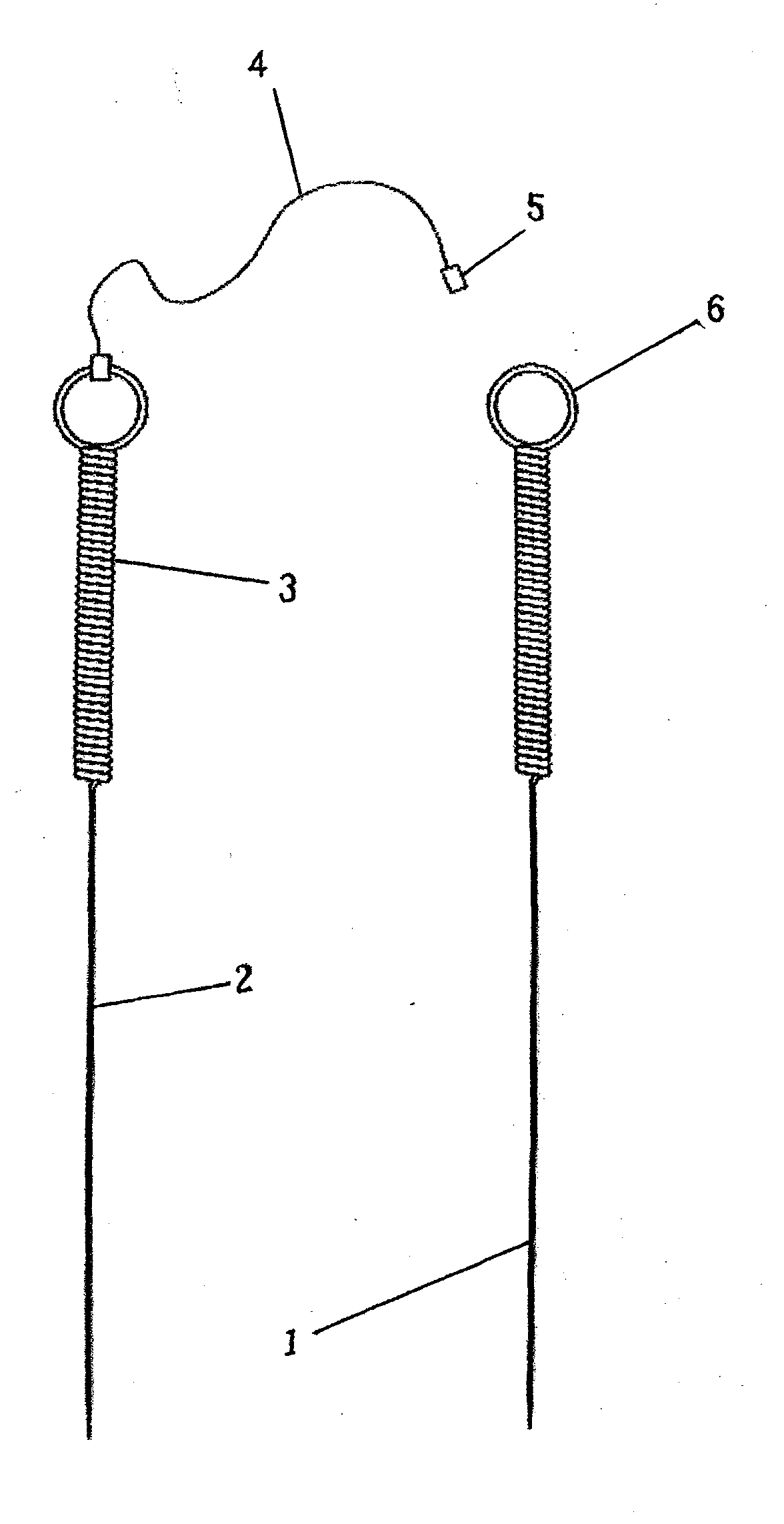 Acupuncture needle with electrolytic effect