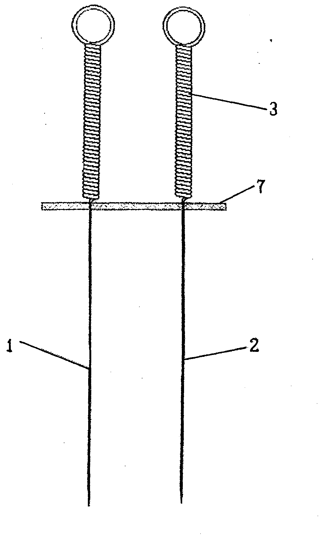 Acupuncture needle with electrolytic effect