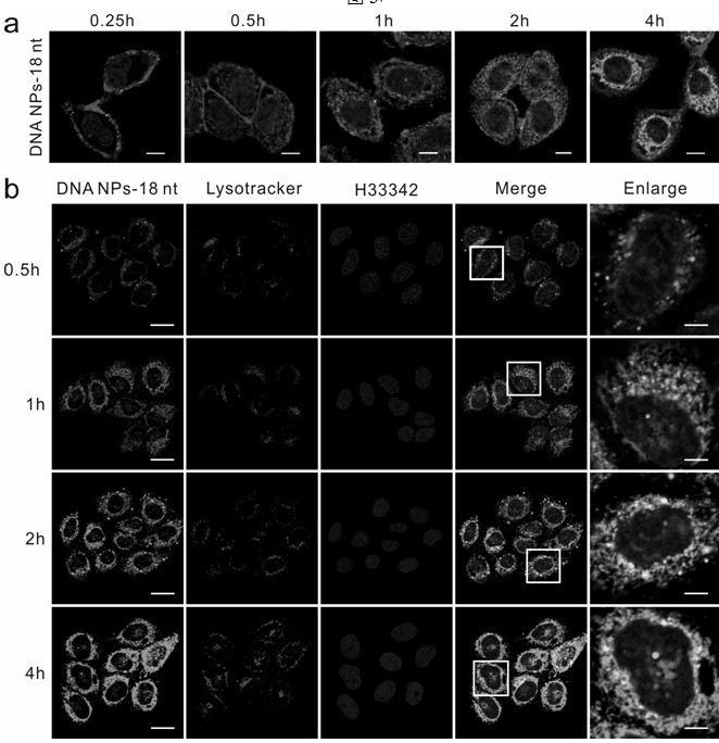 Preparation method and application of nucleic acid spherical nanoparticle medicine