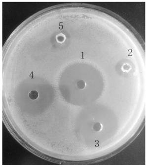 A strain of Bacillus subtilis bys2 with high antibacterial properties