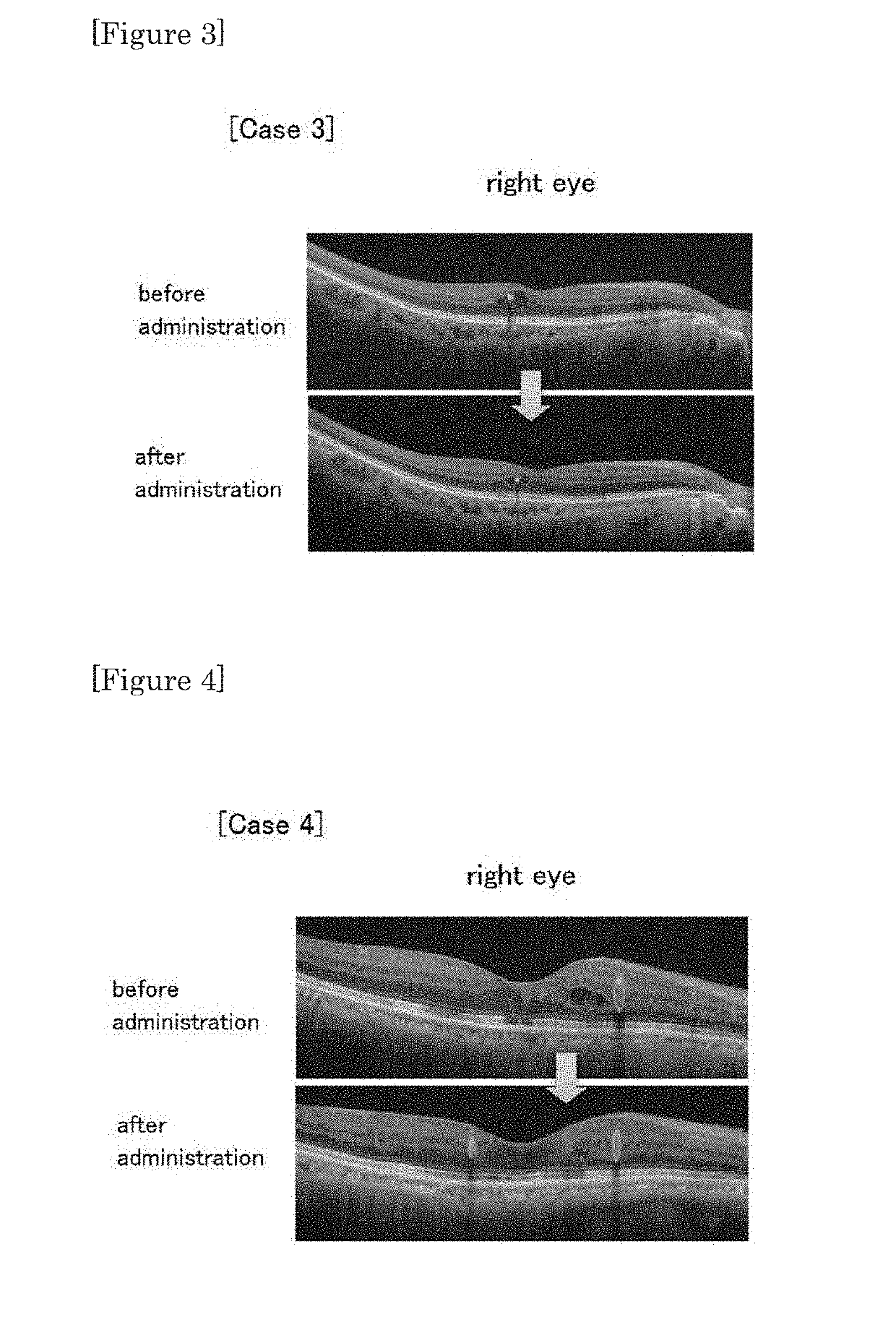 Agent for treating retinopathy