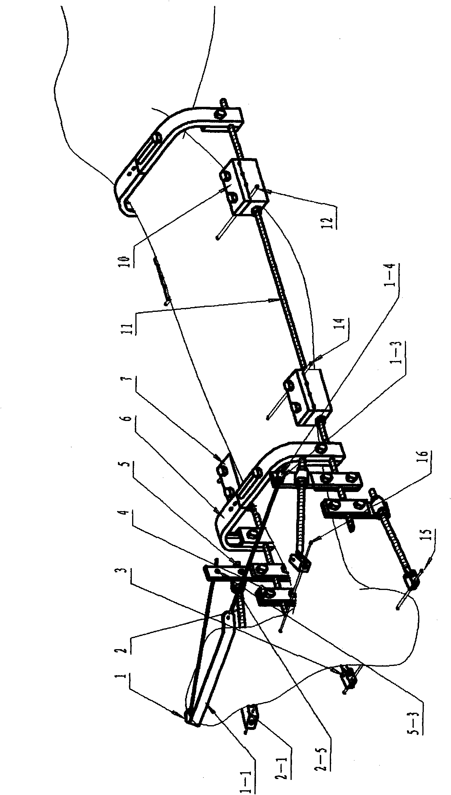 Minimally invasive skeletal external fixation device for correcting foot accelerator drop and talipes varus