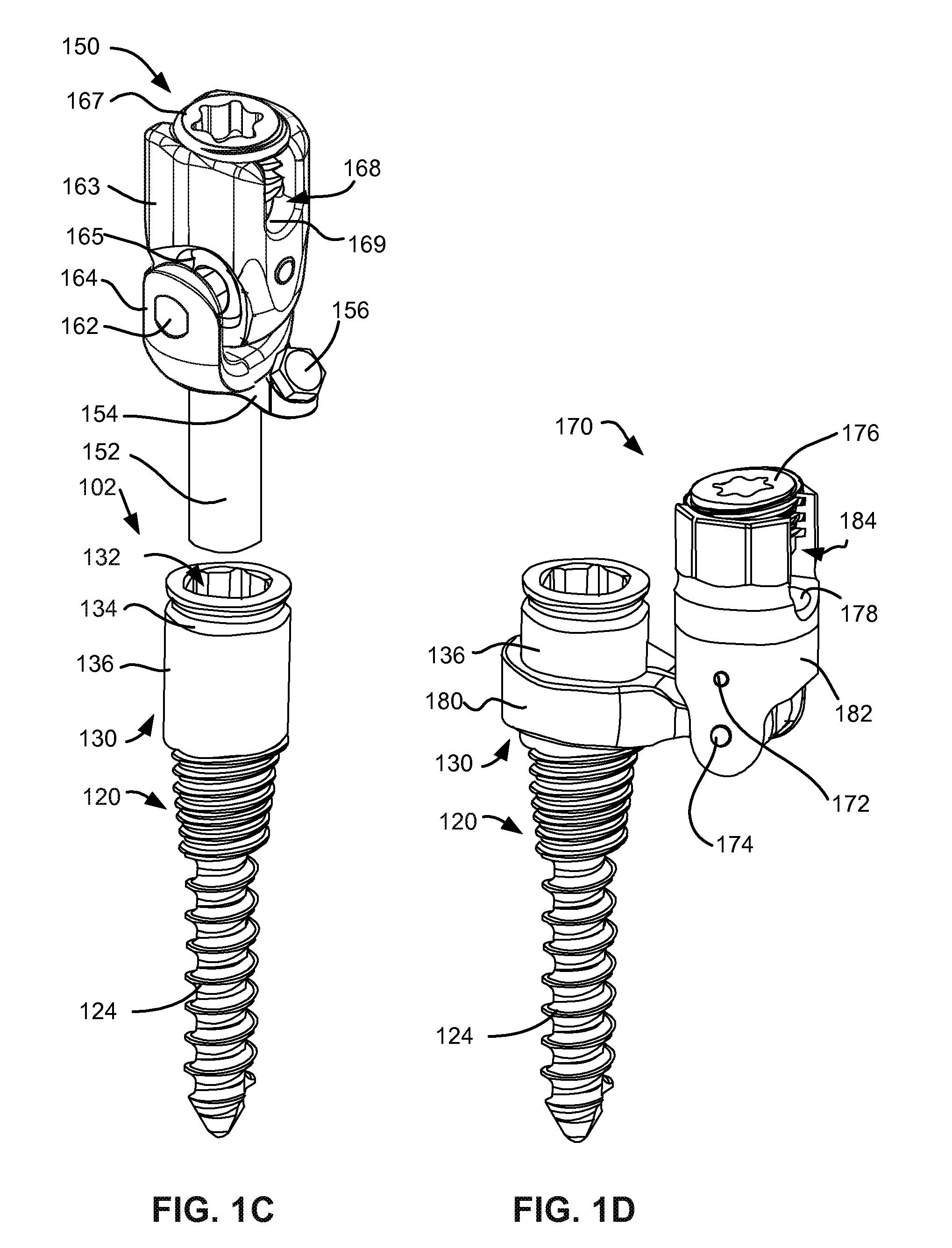 Load-sharing bone anchor having a deflectable post with a compliant ring and method for stabilization of the spine