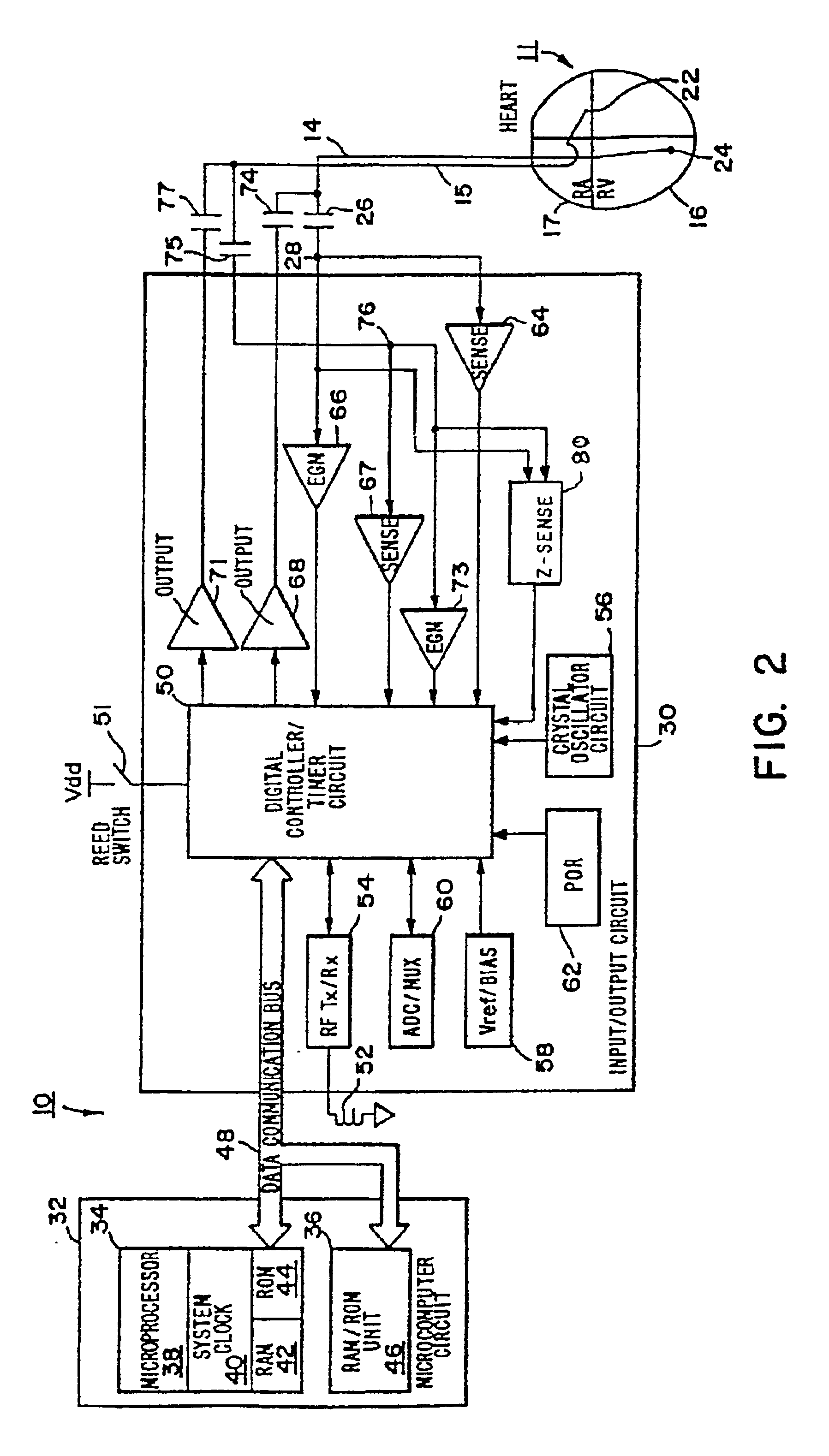 Methods and apparatus for detection and treatment of syncope