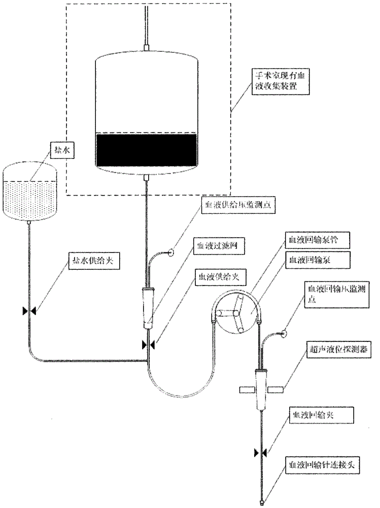 A Synchronous Blood Return System Applied to Bleeding Patients During Operation