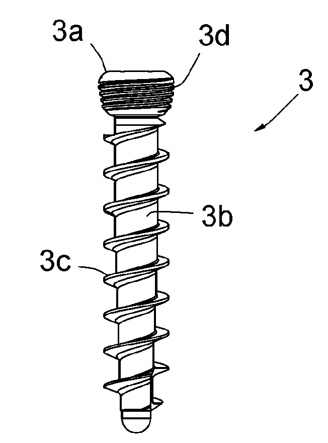 Assembly comprising an implantable part designed to be fastened to one or more bones or bone portions to be joined, and at least one screw for fastening the implantable part to said bone(s)