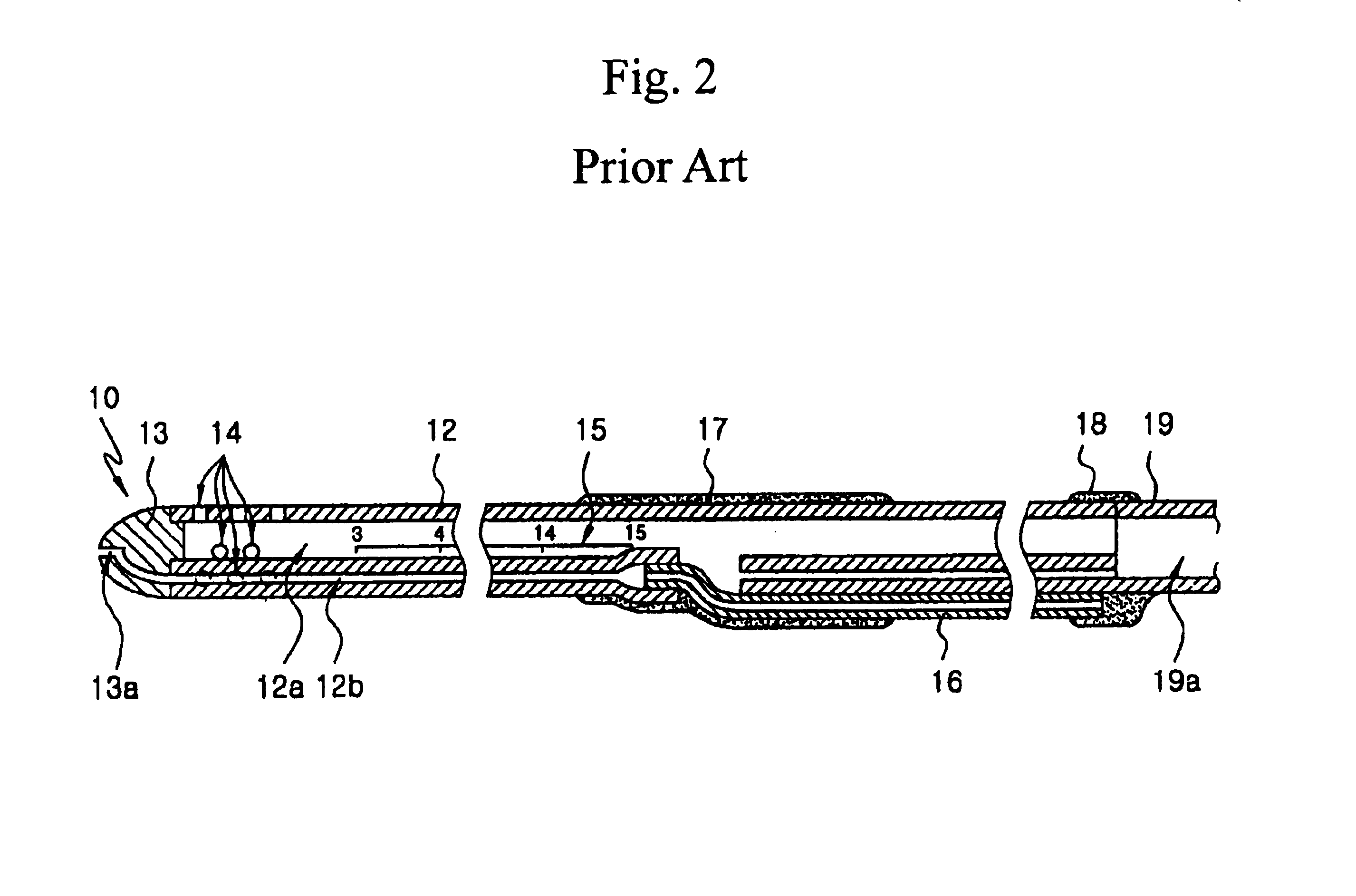Catheter for extracting and inserting humors