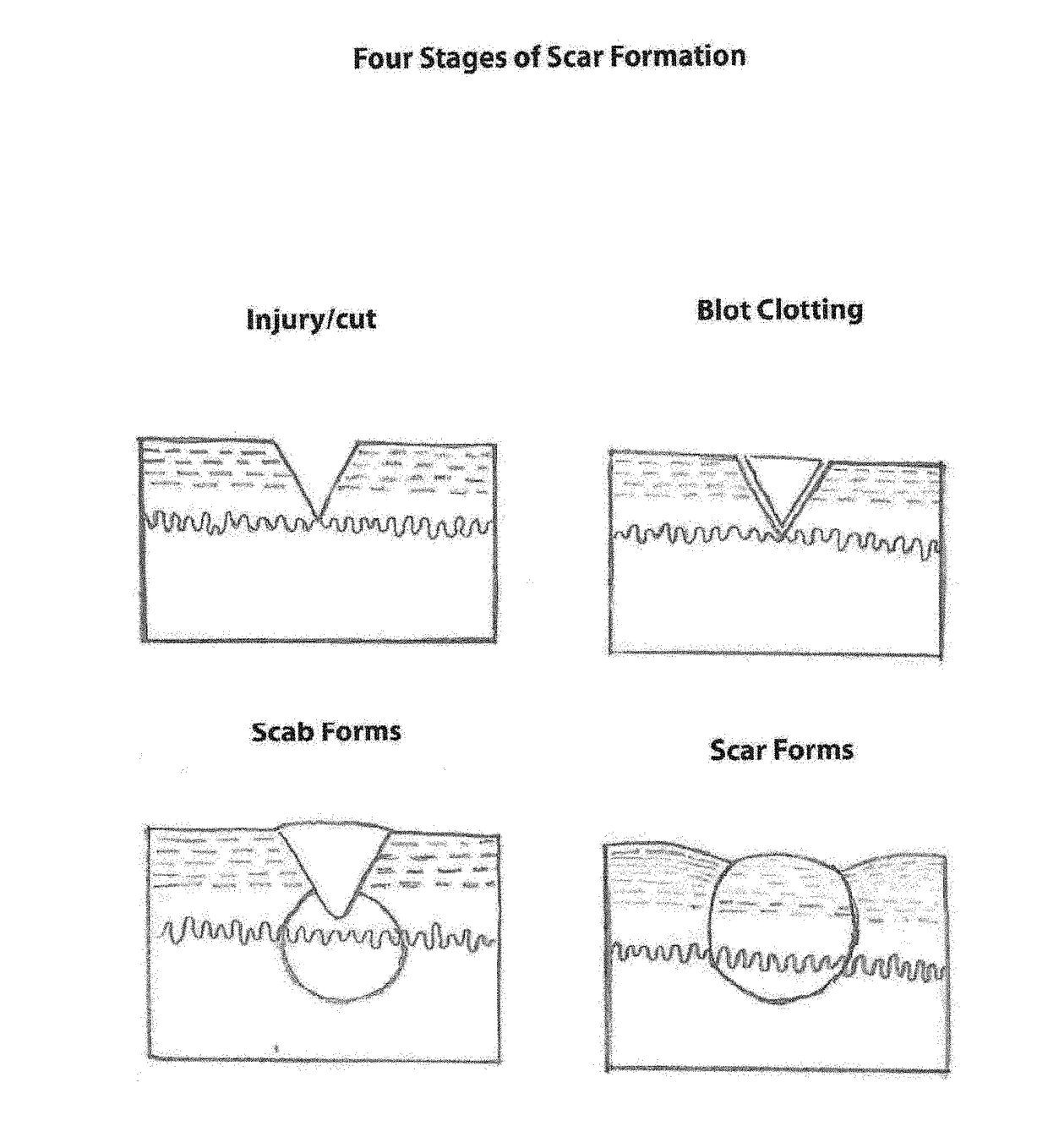 Method and system for rehabilitation of scar tissue