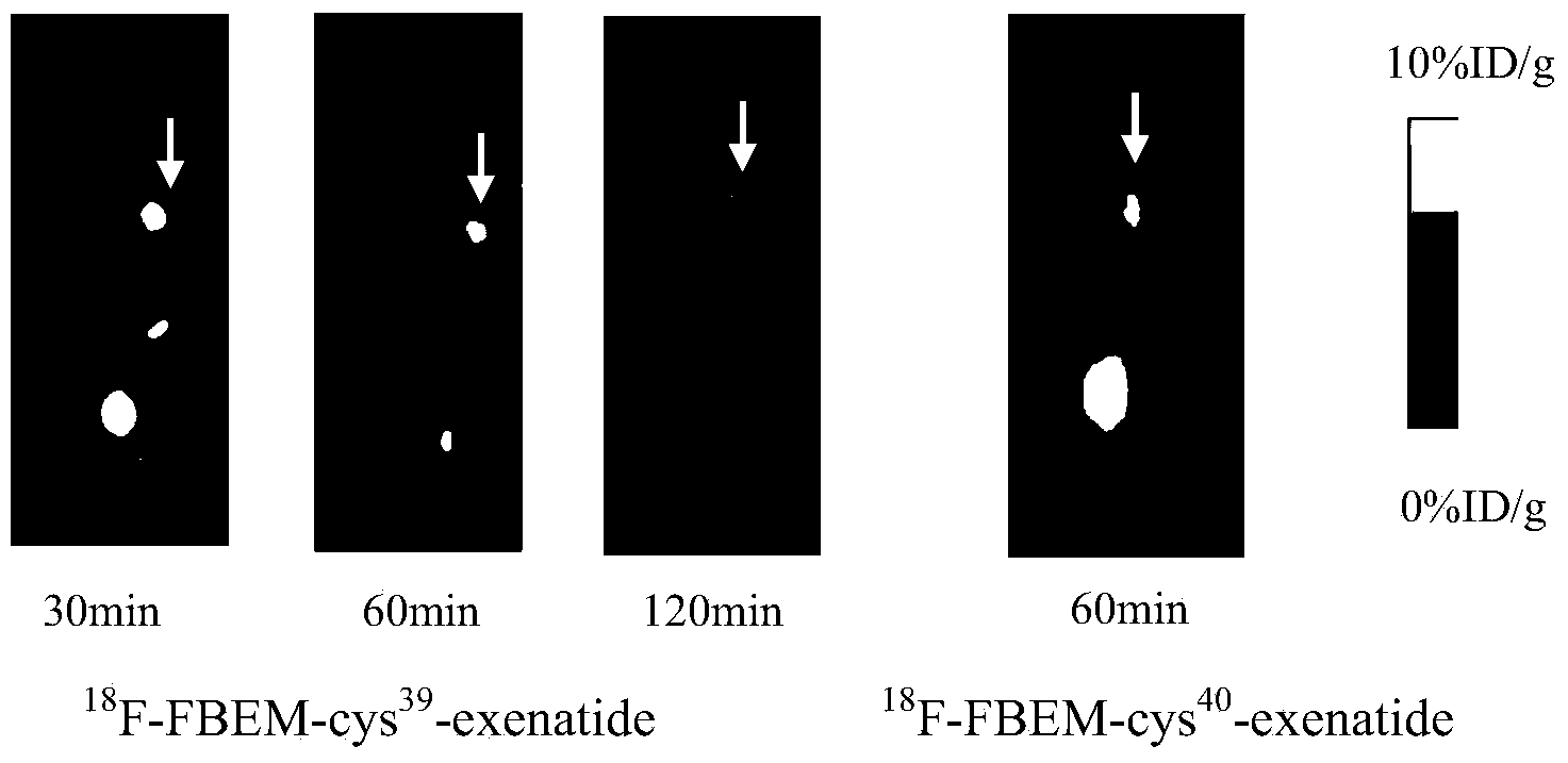 Exenatide &lt;18&gt;F marker, and preparation method and application thereof