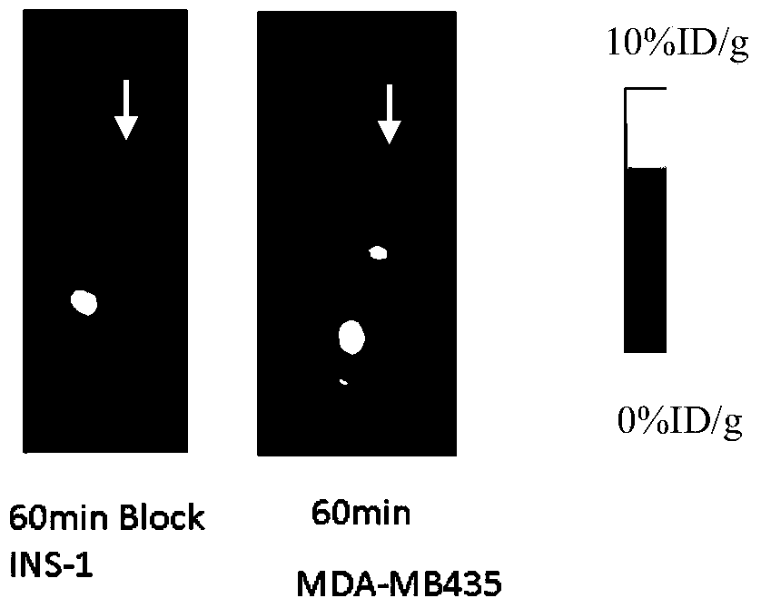 Exenatide &lt;18&gt;F marker, and preparation method and application thereof