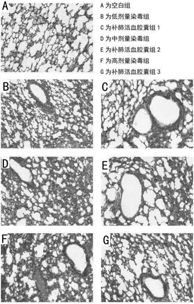 Use of Bufei Huoxue Capsules for the treatment or prevention of lung injury caused by PM2.5