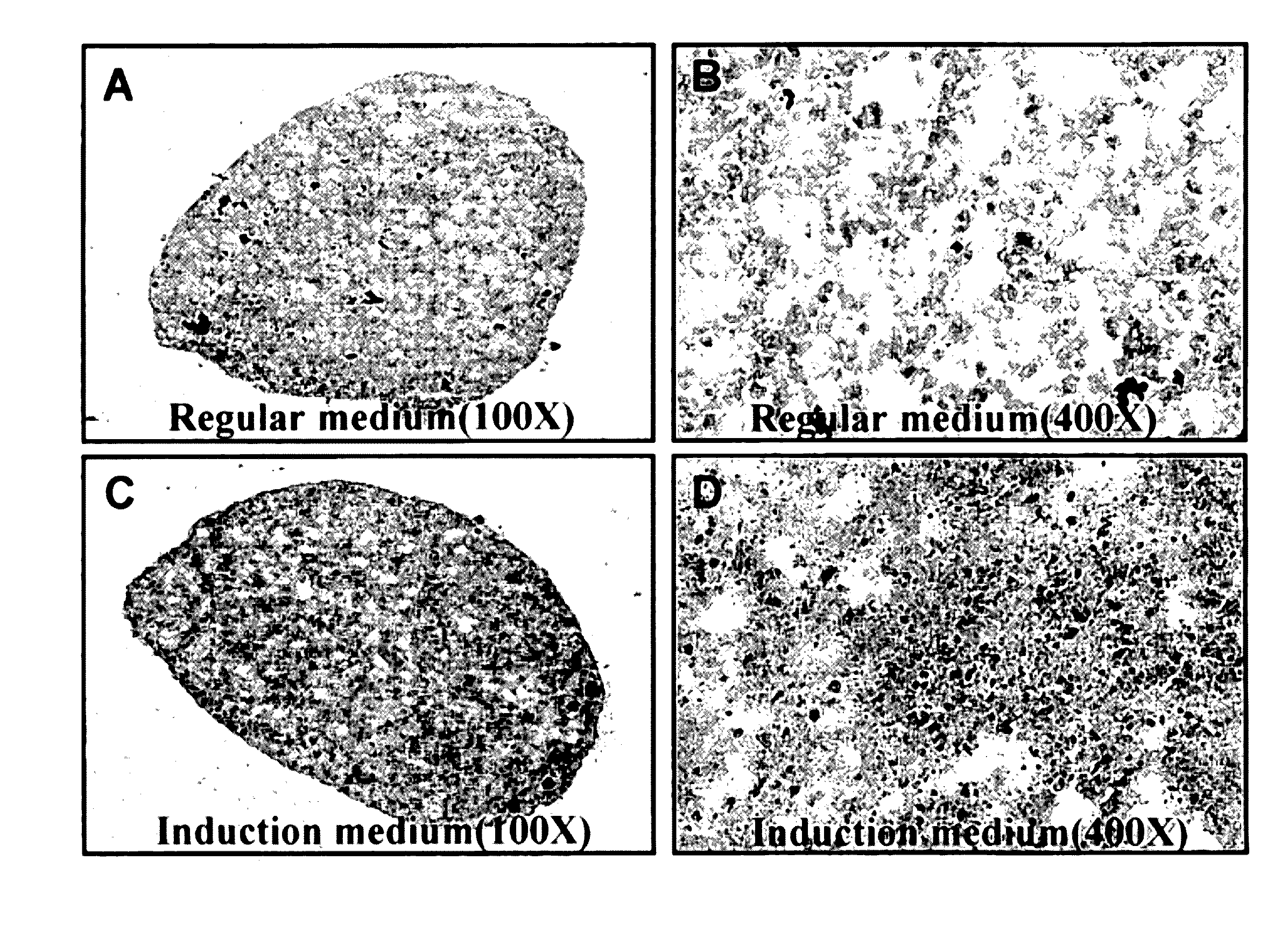 Method for treating pancreatitis with mesenchymal stem cells