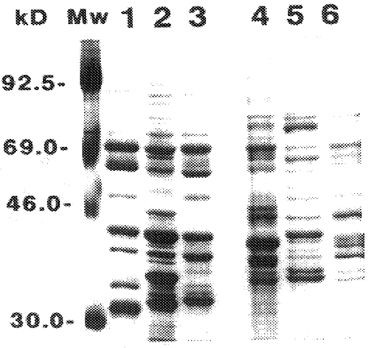 66 kDa antigen from Borrelia