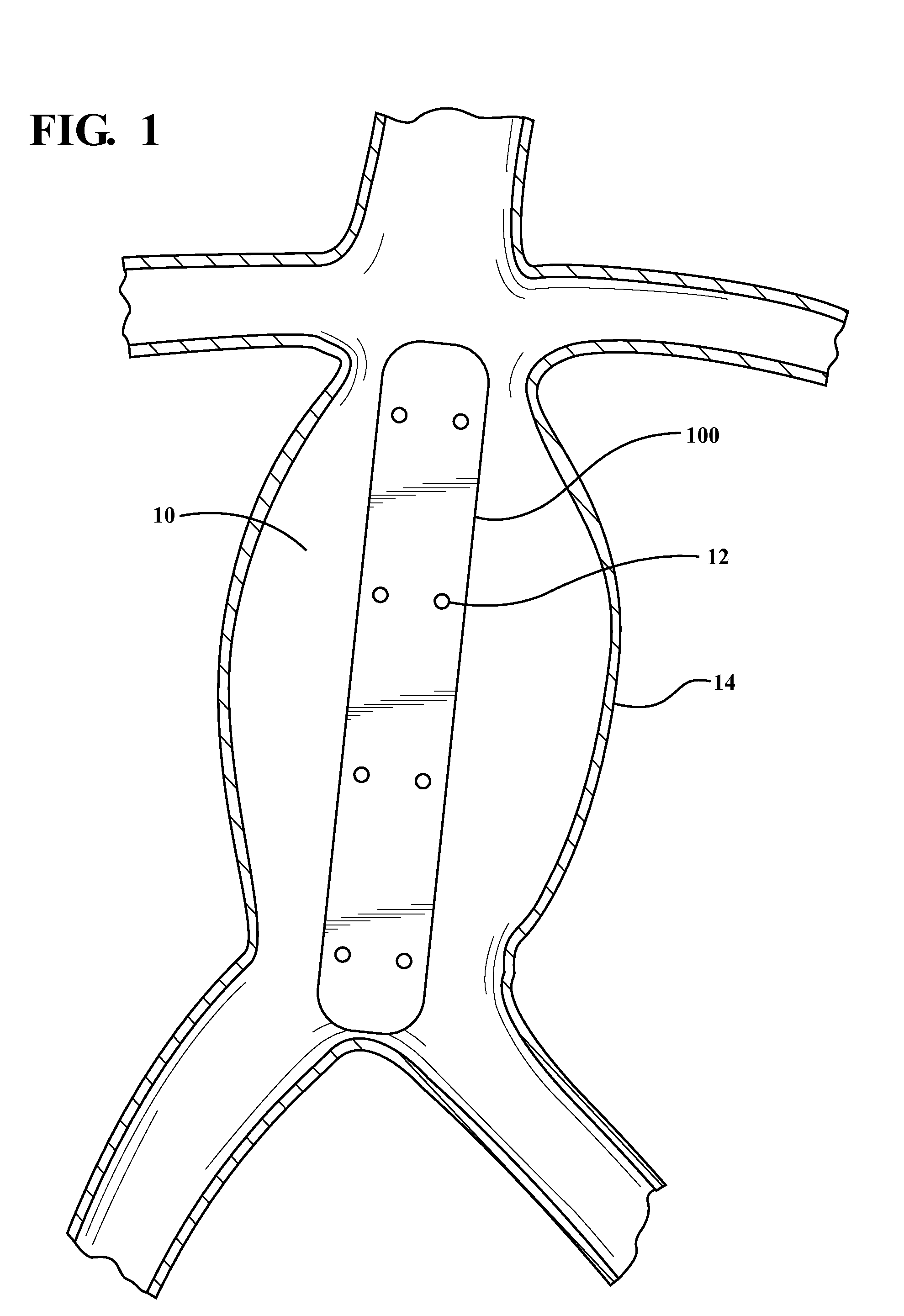 Lumbar ostia occlusion devices and methods of deploying the same