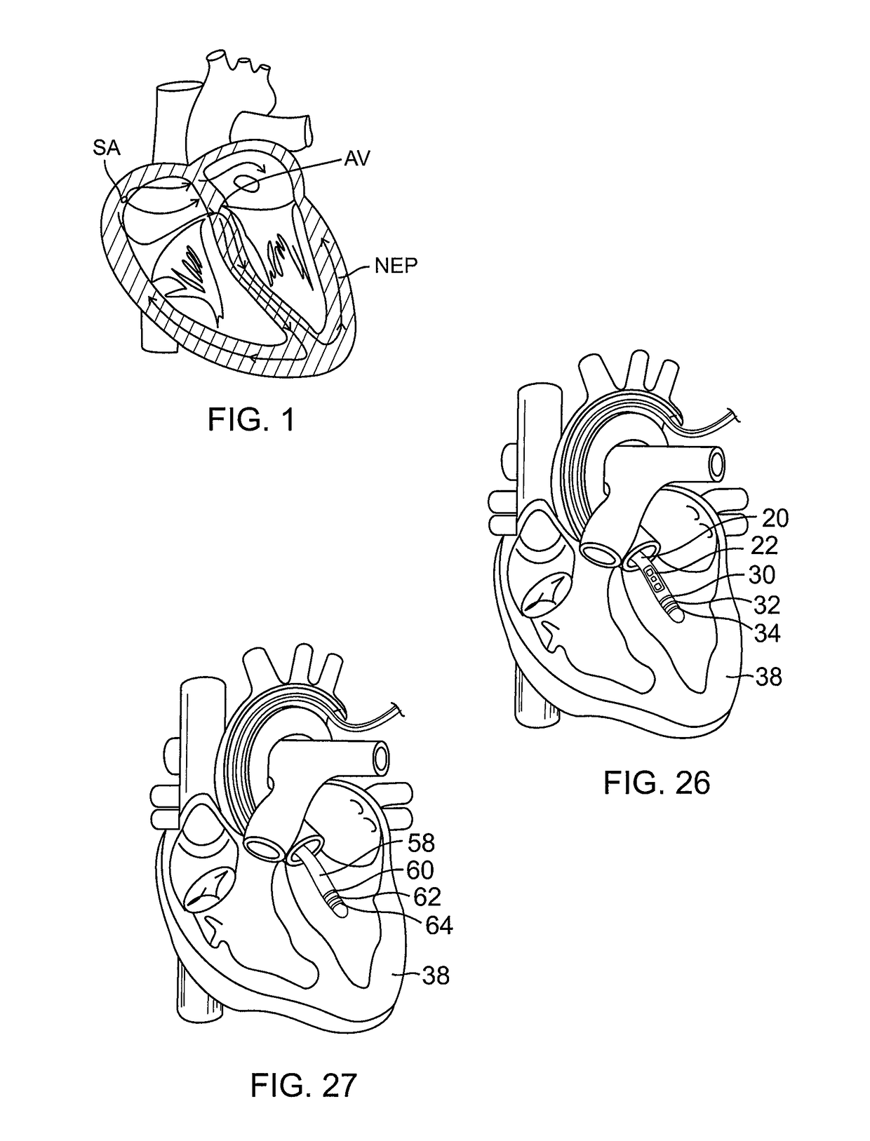 System and method for visualizing electrophysiology data