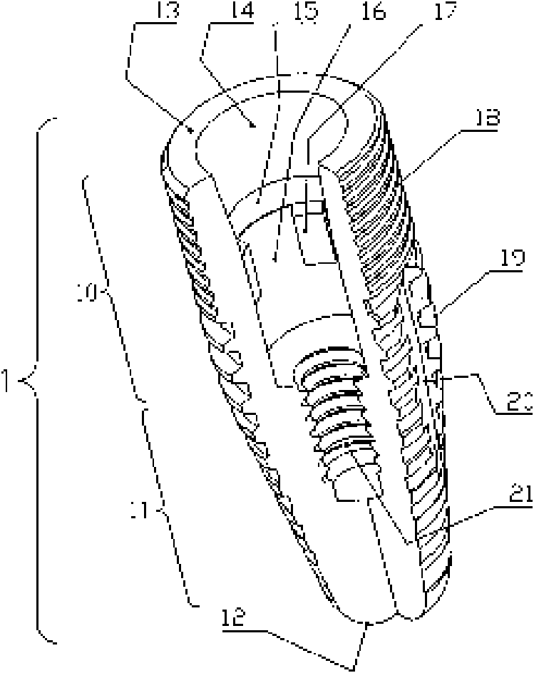 Oral implant device and implant length computation method