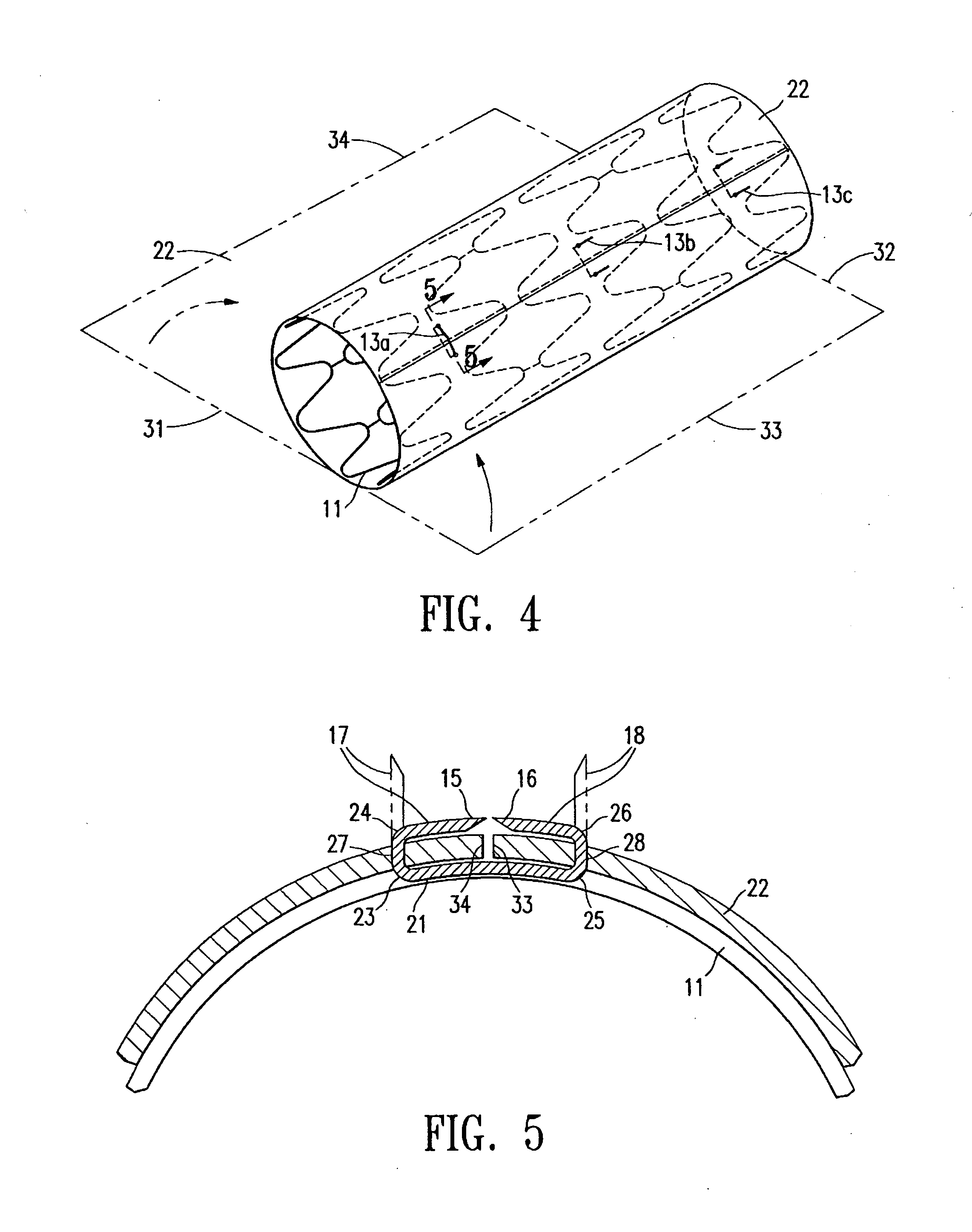 Stent with cover connectors