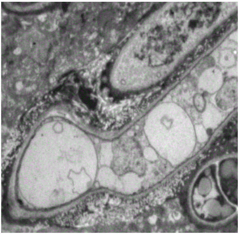 Application of cinnamaldehyde in preparation of drugs for targeted therapy of drug-resistant aspergillus infection