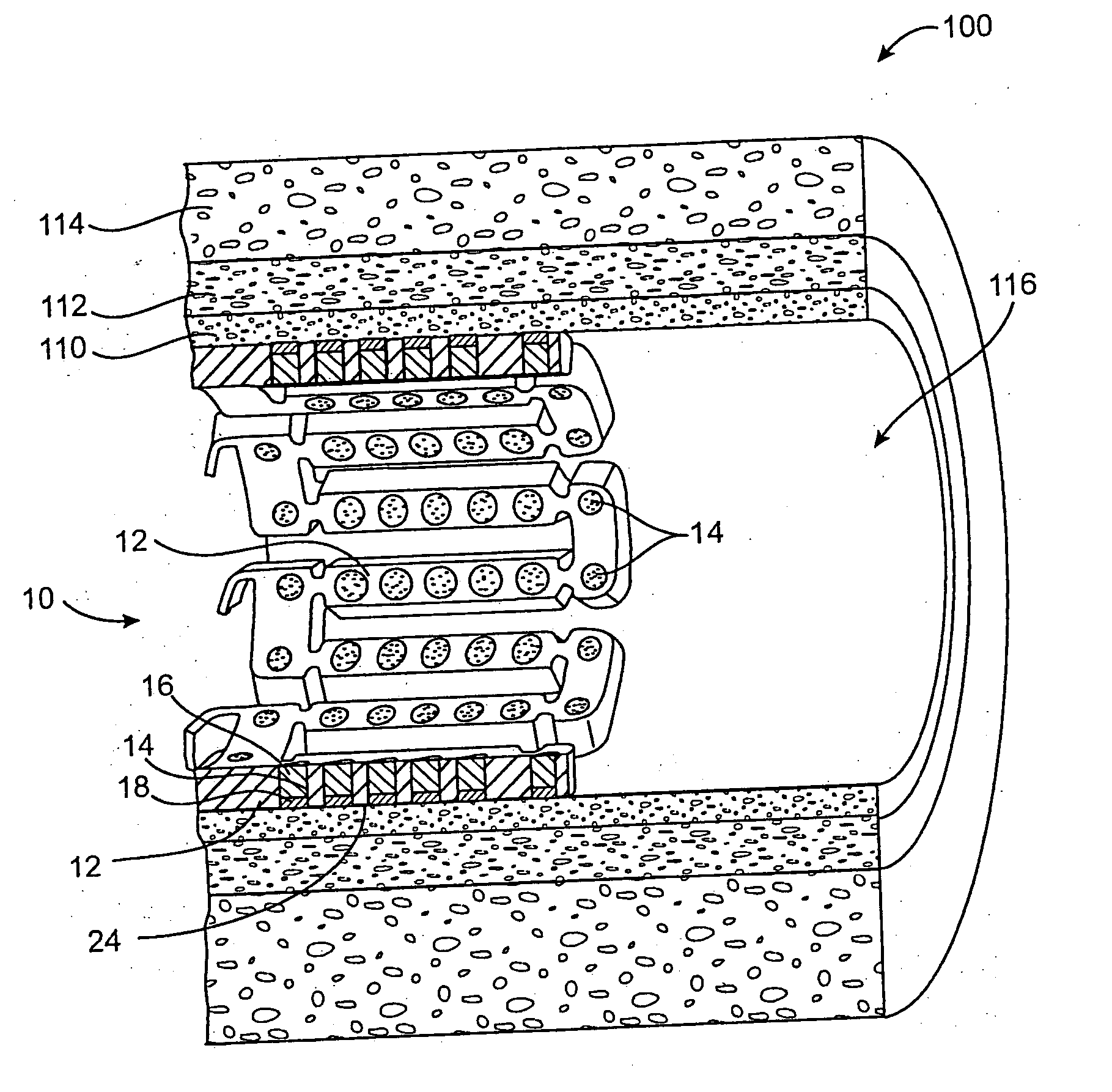 Method and apparatus for reducing tissue damage after ischemic injury