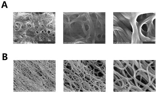 Application of fullerenol and its composition in the preparation of antithrombotic drugs