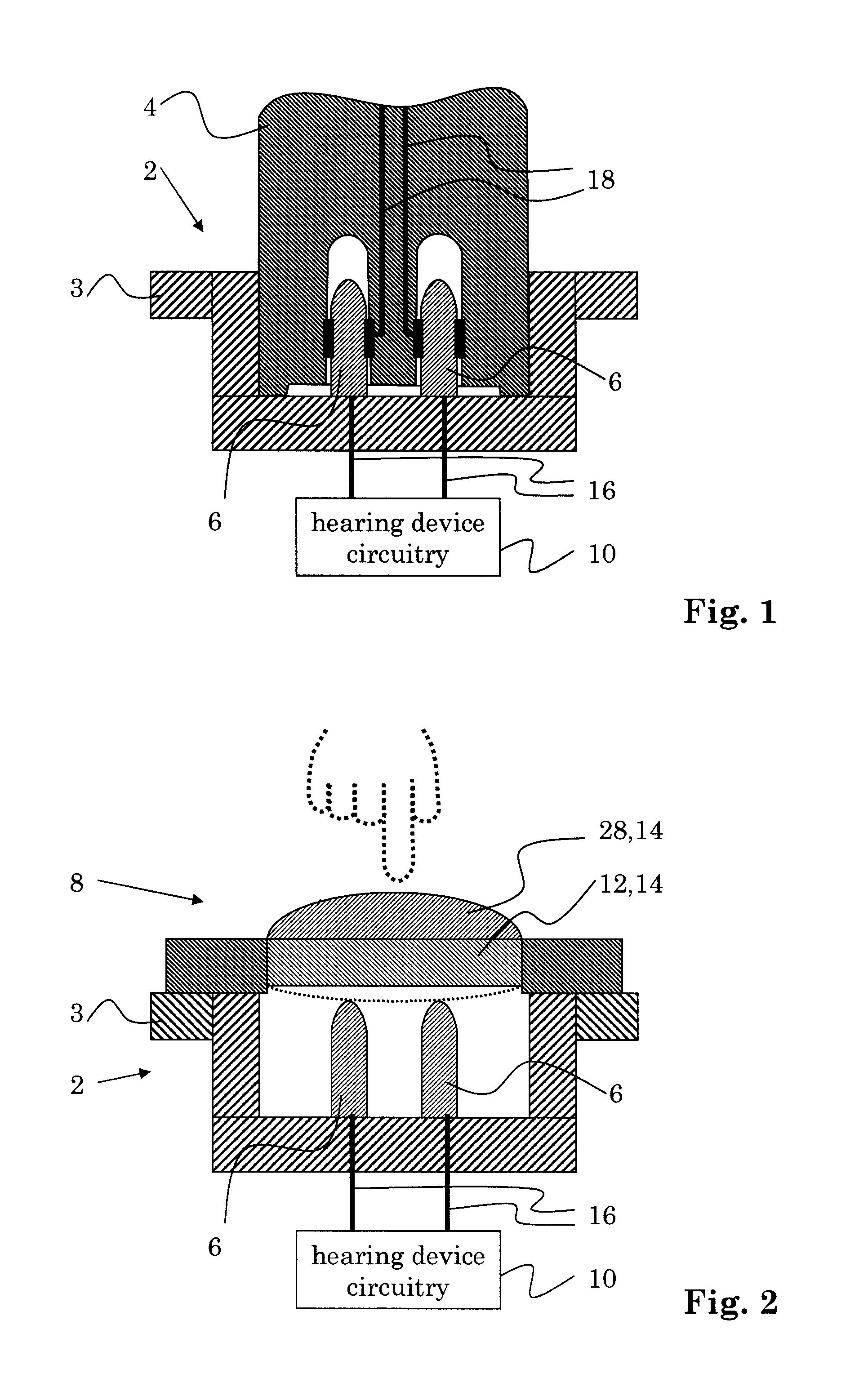 Hearing device with user control