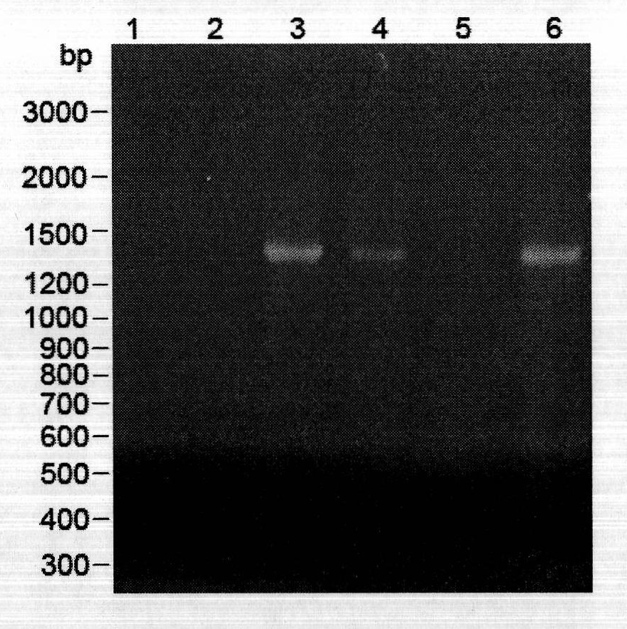 Application of recombinant pichia pastoris bacterial strain