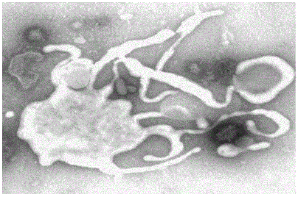 Mycoplasma hyorhinosus strain and its inactivated vaccine and application