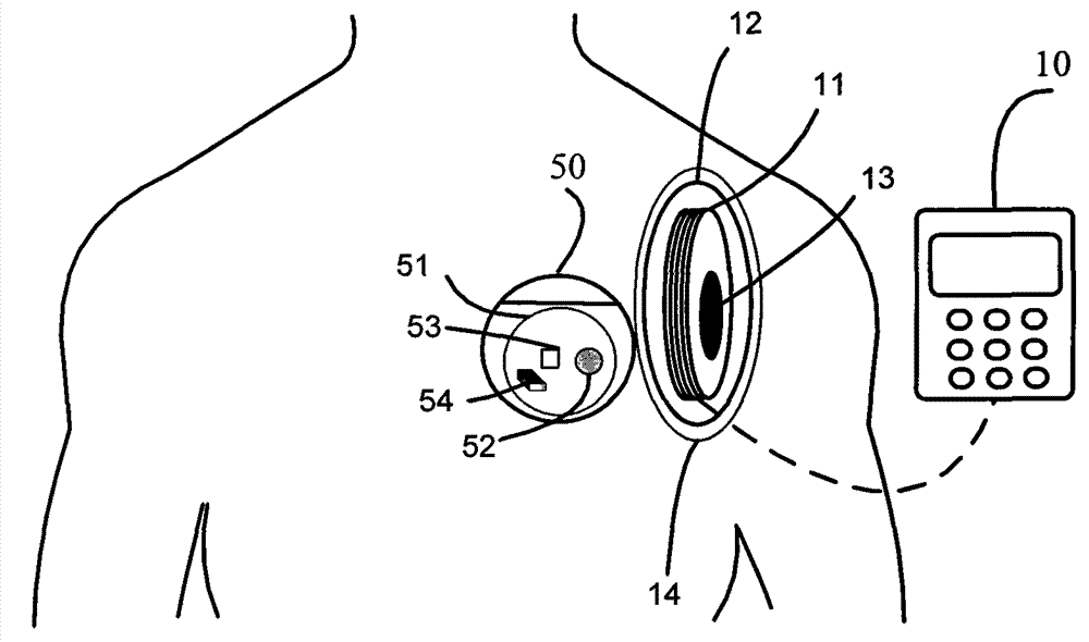 Percutaneous wireless charging device with frequency modulation and amplitude modulation function applied to implantation type medical instrument