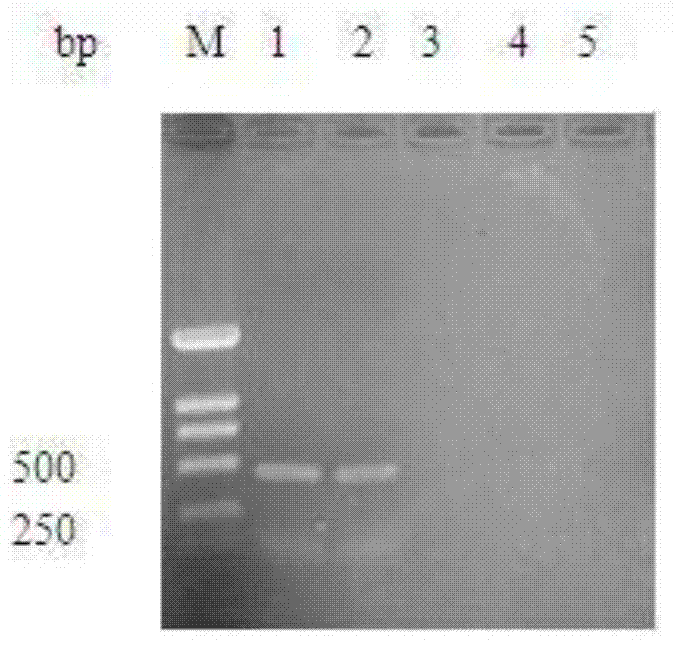 Preparation method of refined egg yolk antibody for duck viral hepatitis