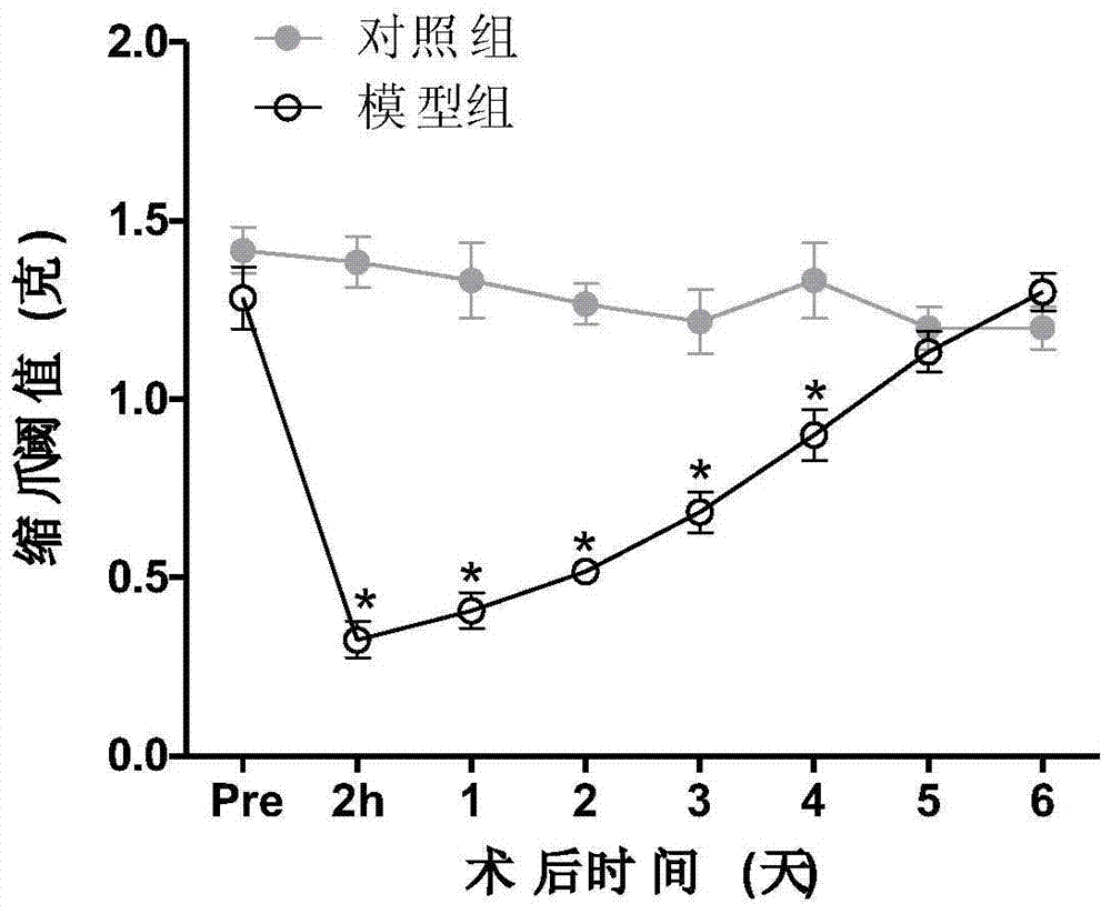 Application of vitexin in preparation of medicine for treating postoperative pain