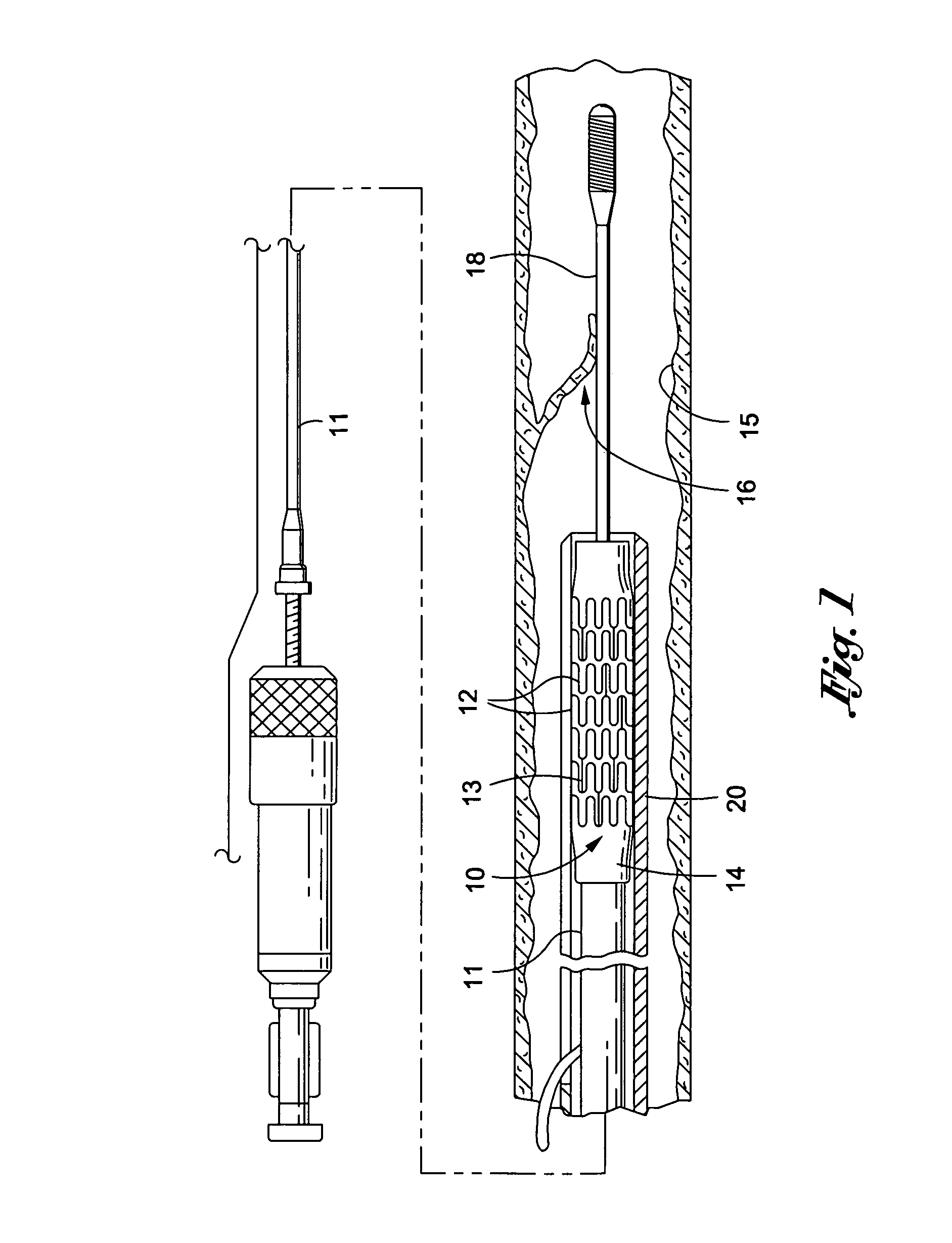 Stent crimping device